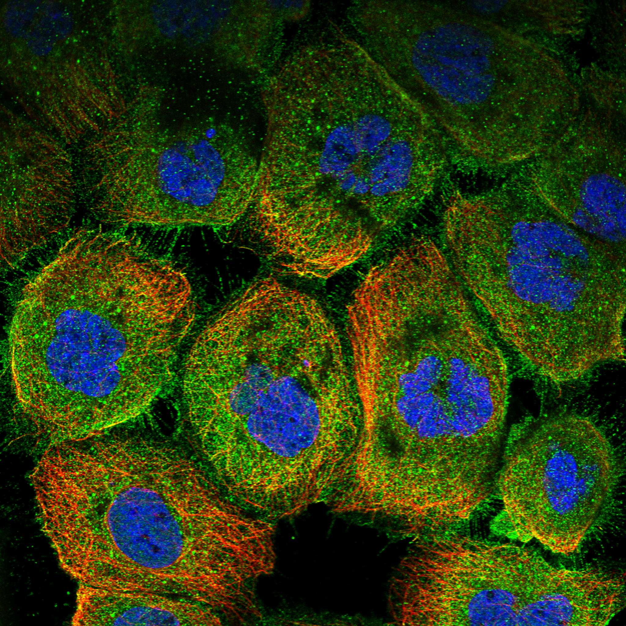 AADAT fluorescence