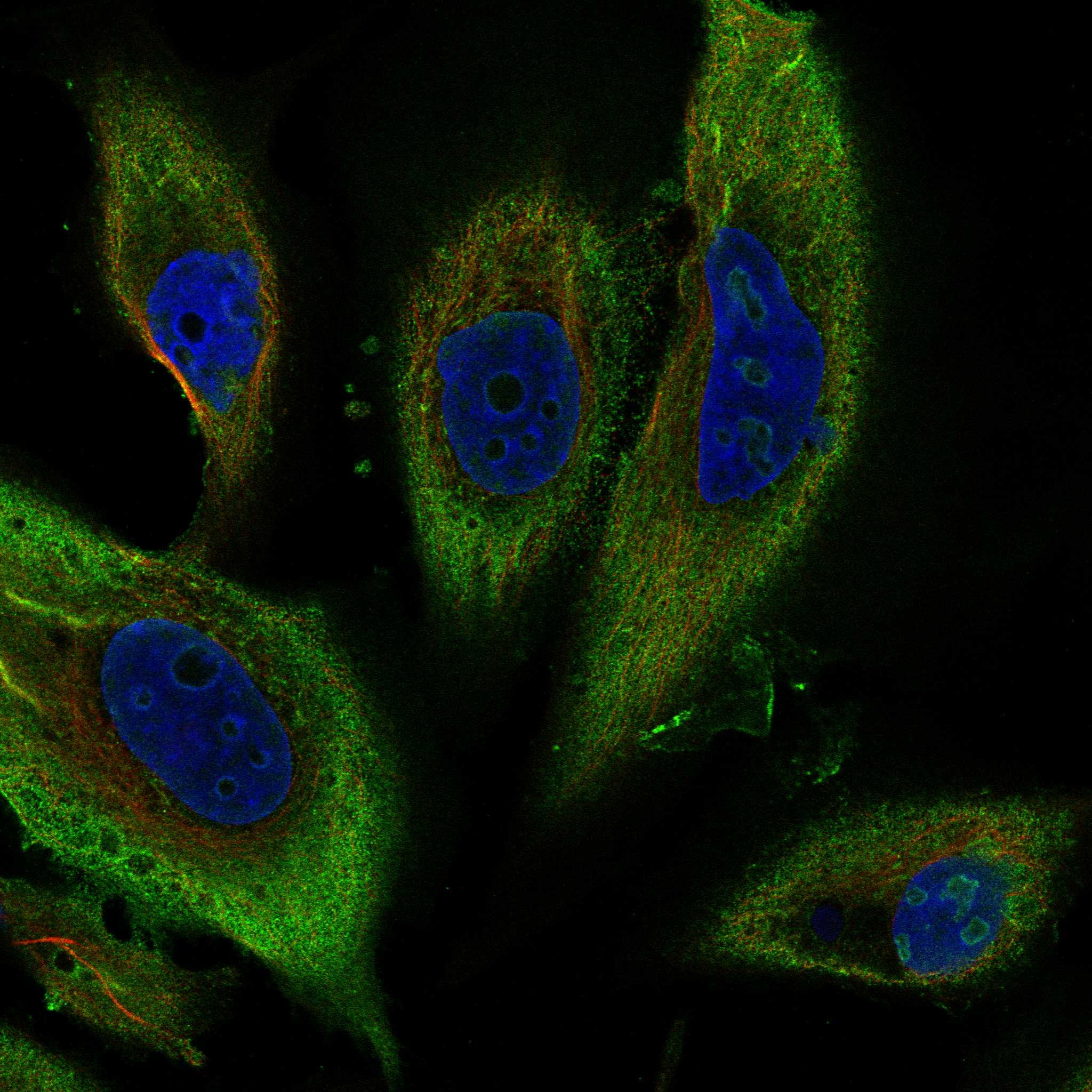 ABCA1 fluorescence