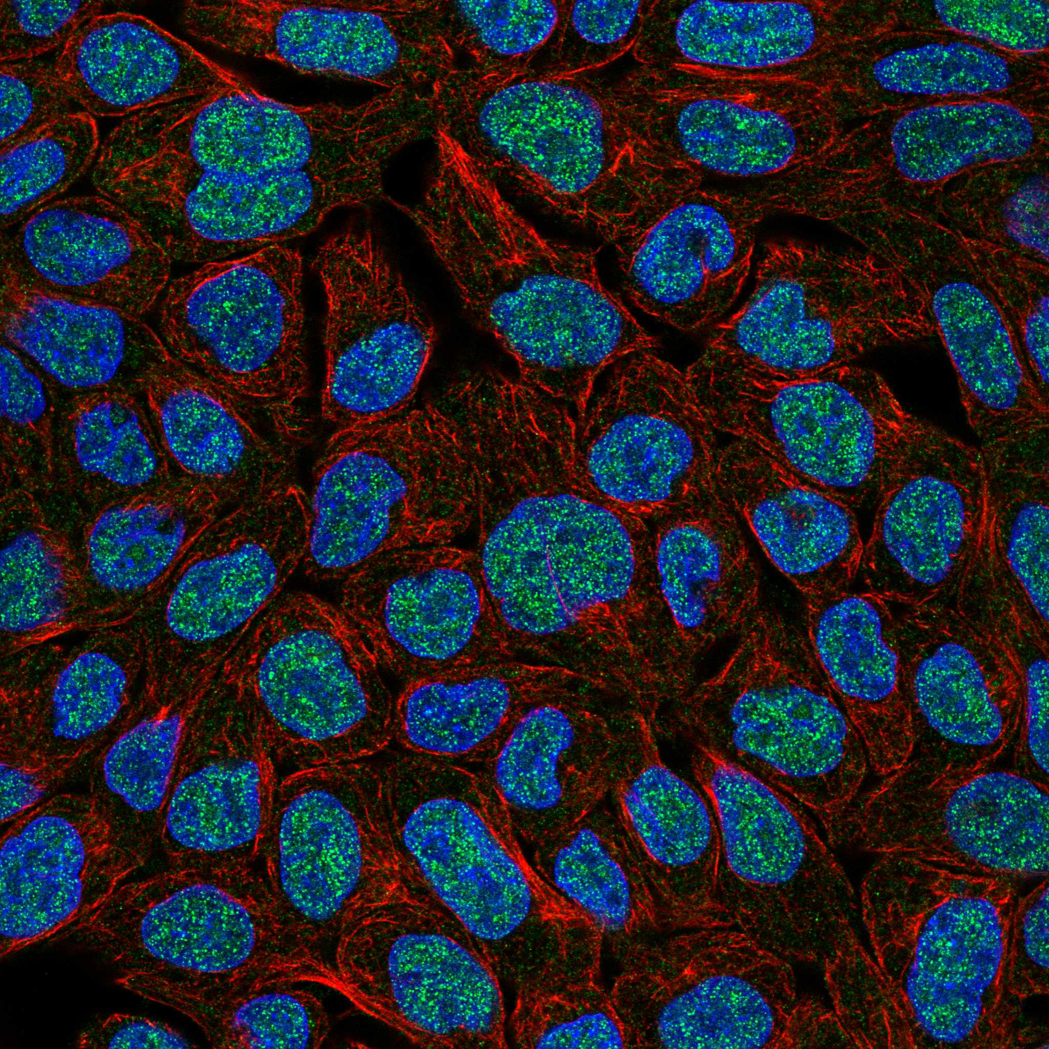 ABCA5 fluorescence