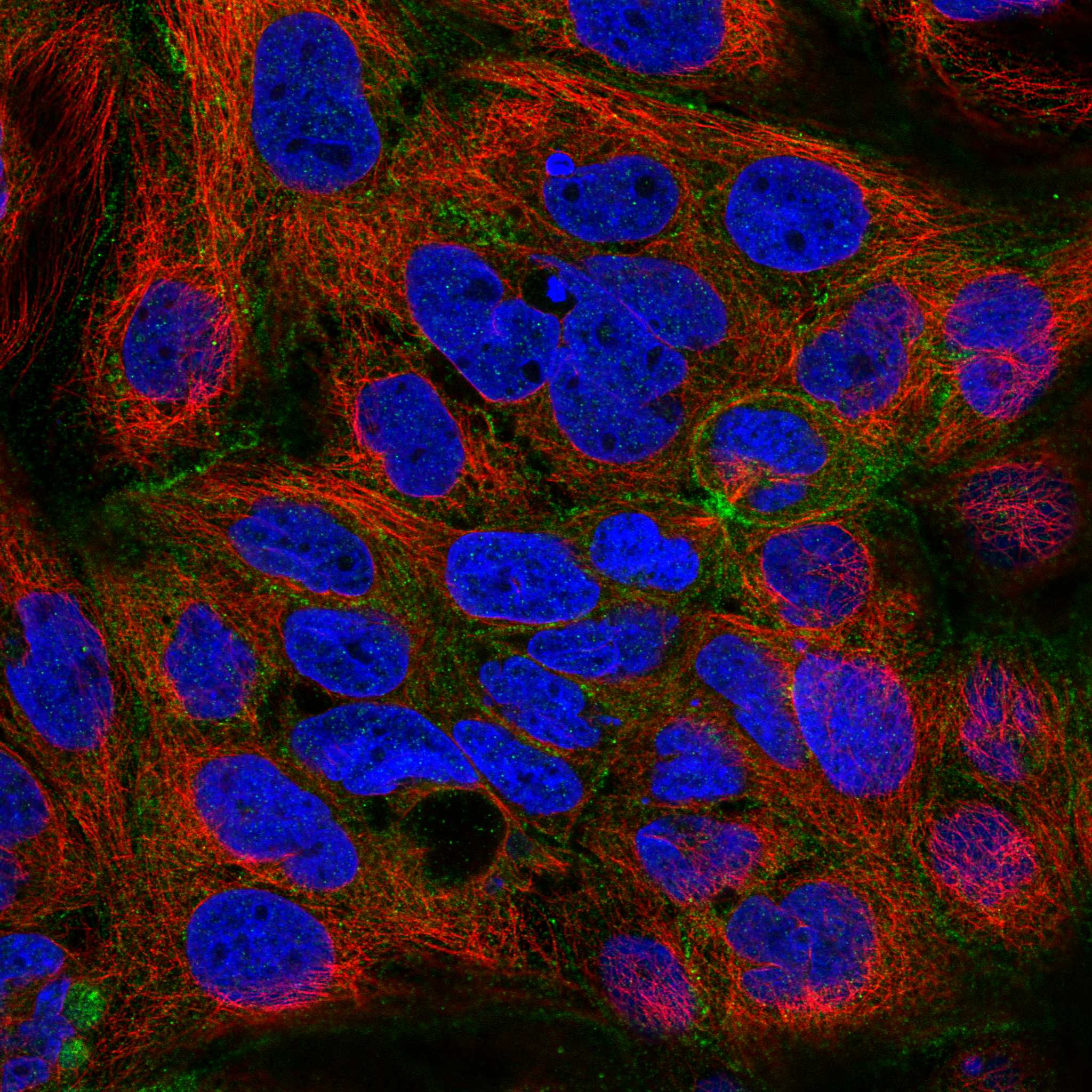 ABI1 fluorescence