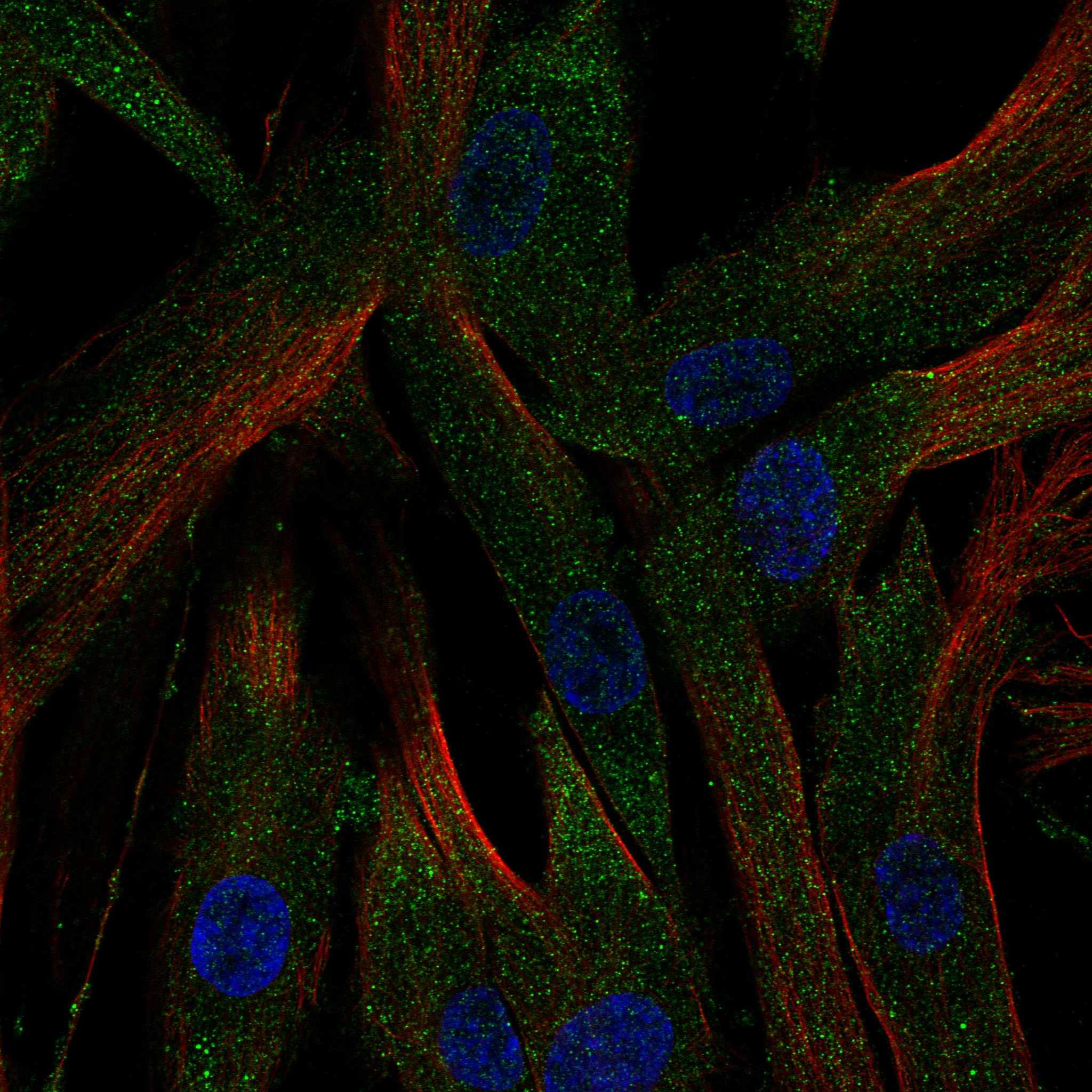ACE fluorescence