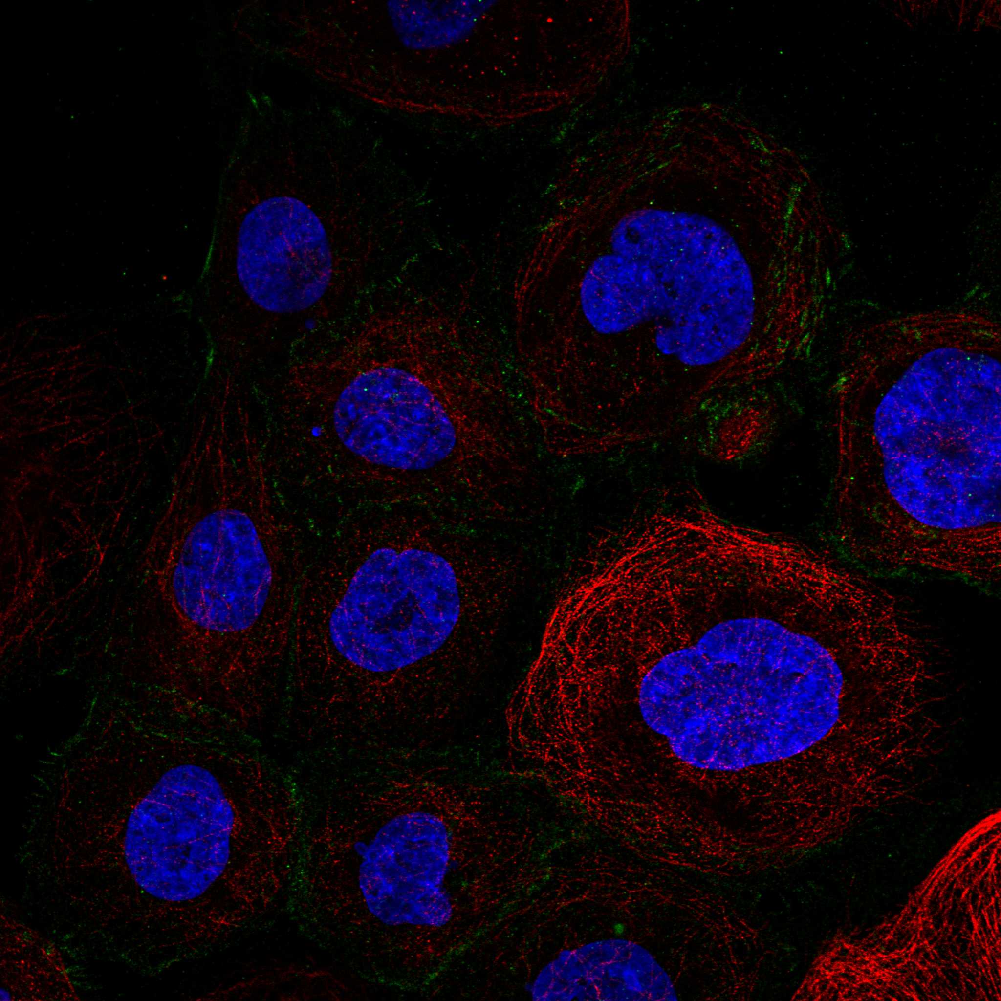 ACTN1 fluorescence