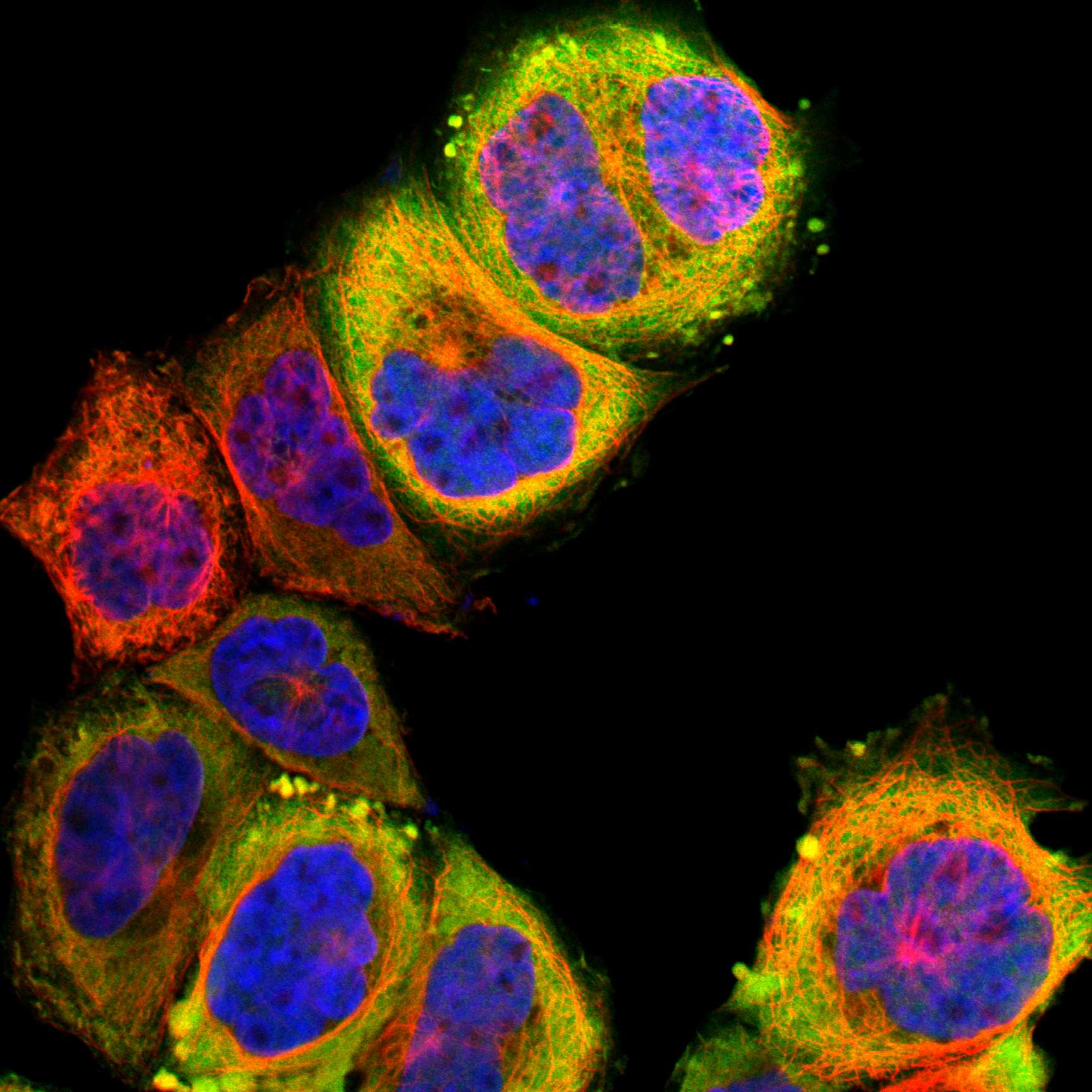 ADA fluorescence