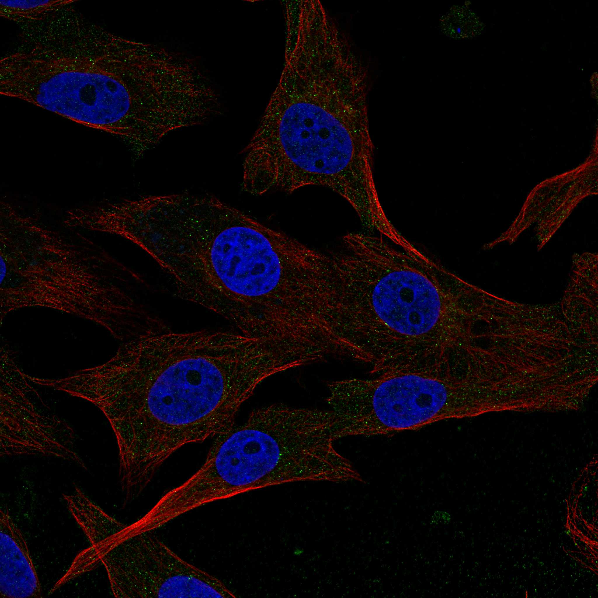 ADCY5 fluorescence