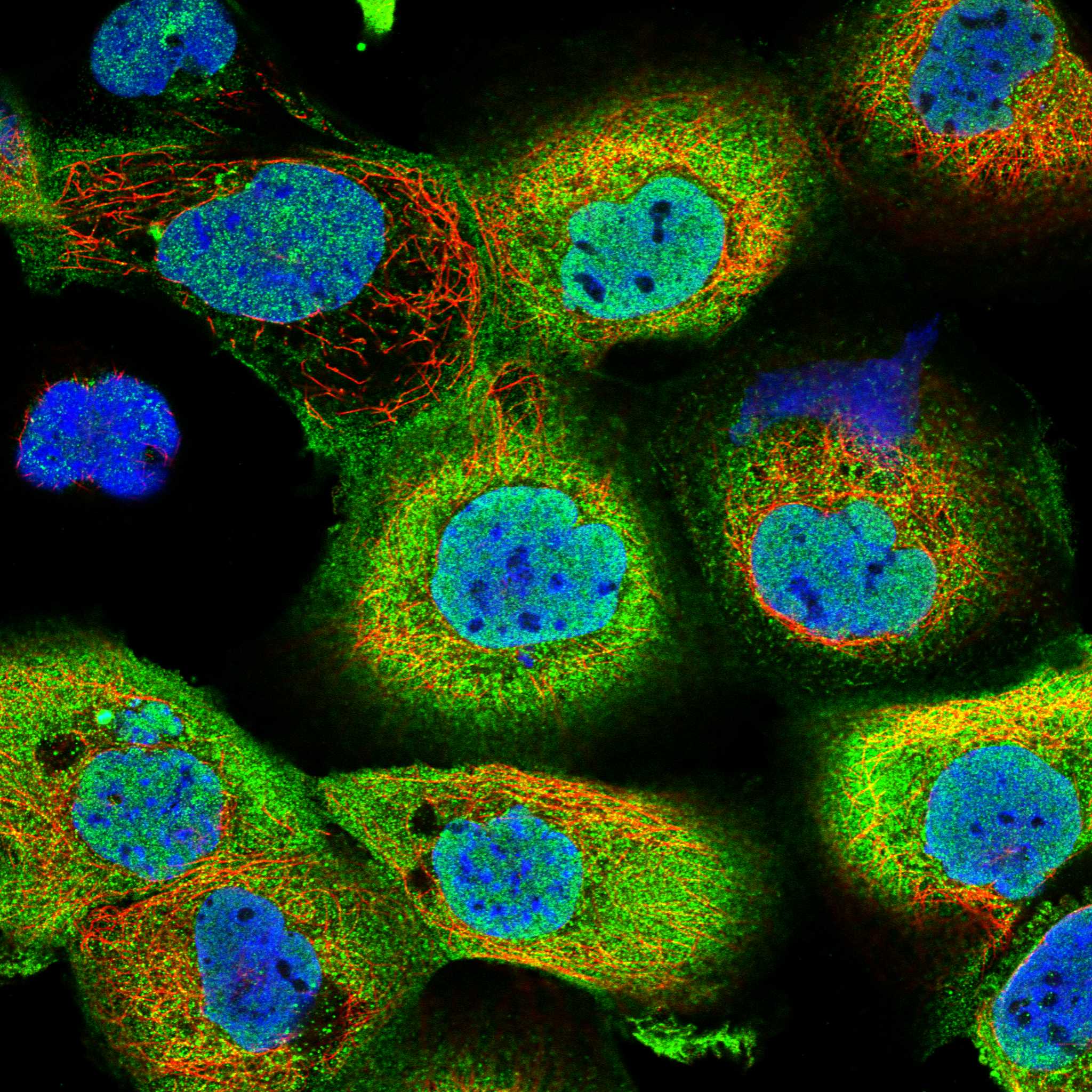 ADRM1 fluorescence