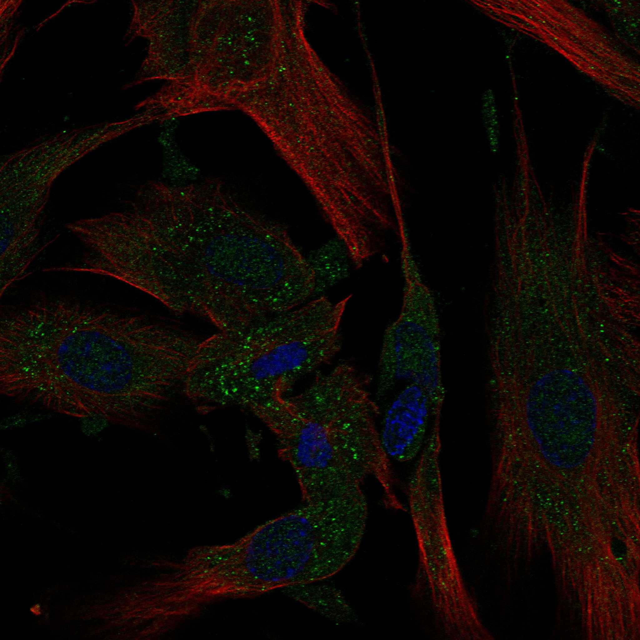 AGTR1 fluorescence