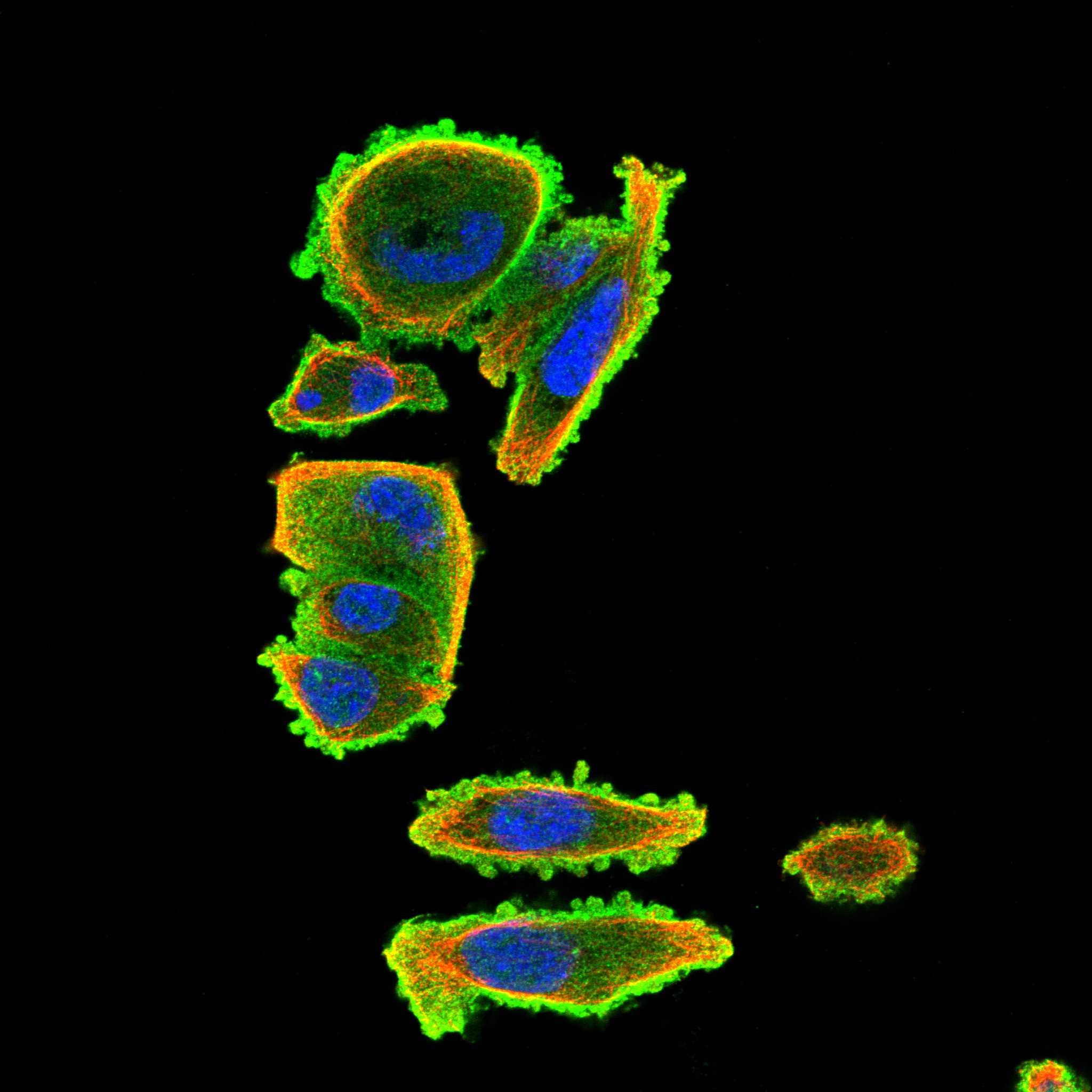 ANK3 fluorescence