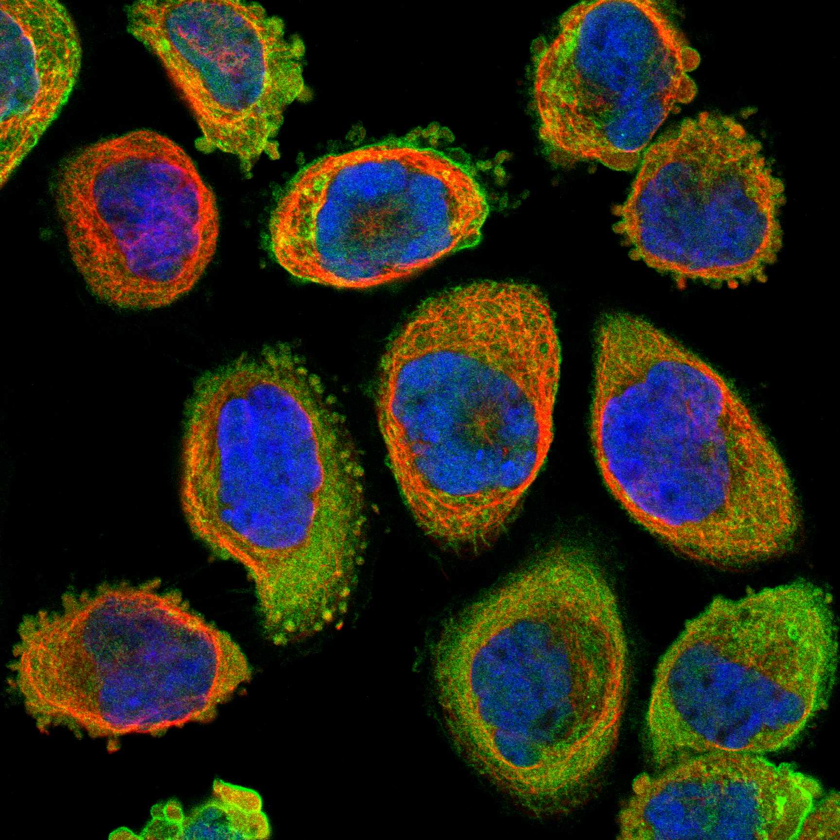 ANXA1 fluorescence