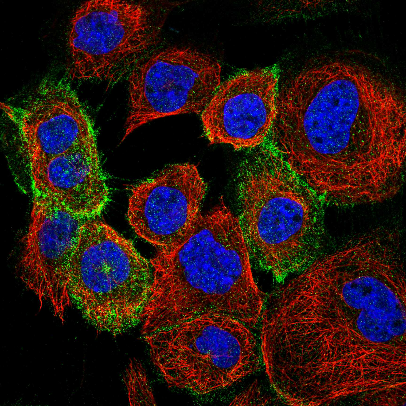 AQP4 fluorescence