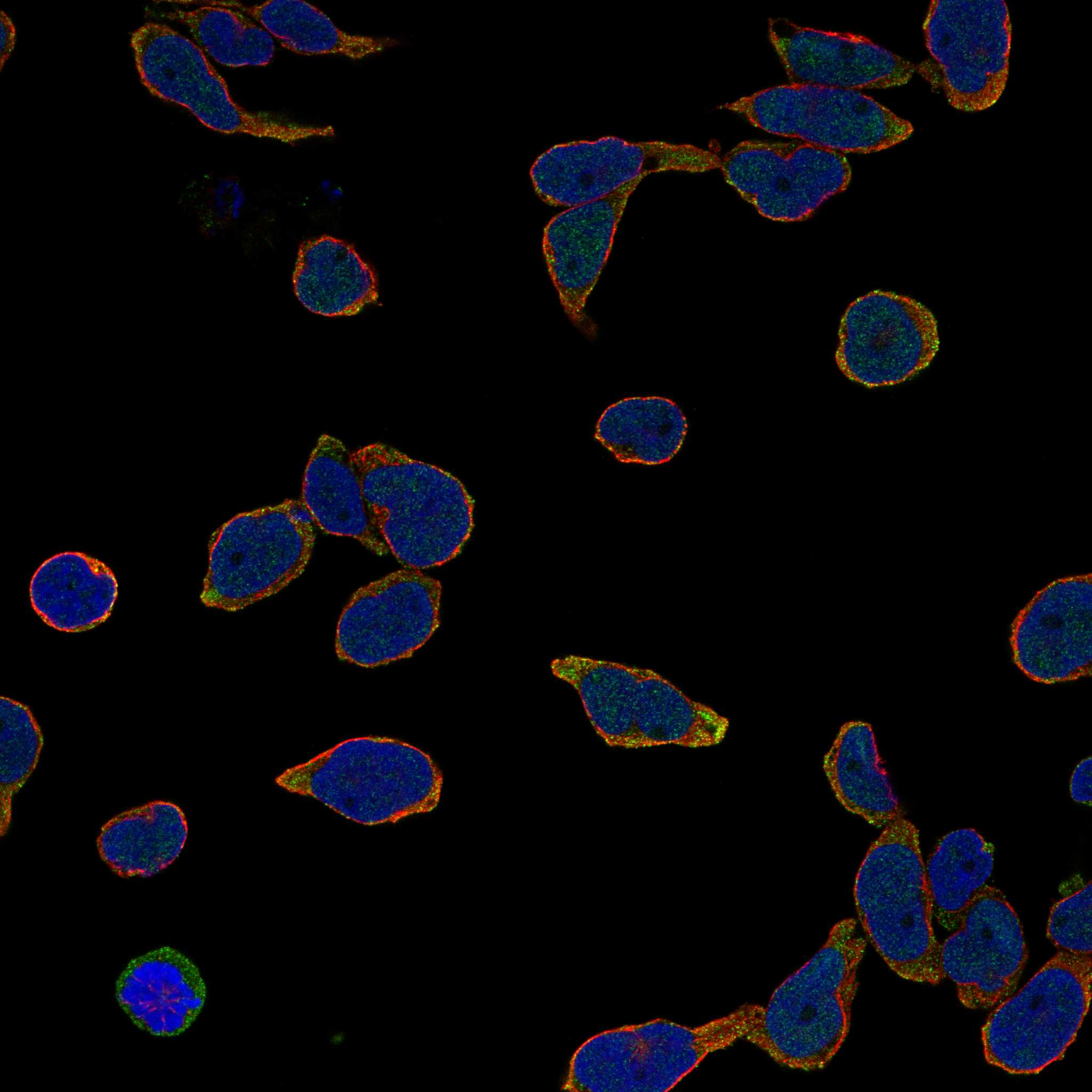 AQP5 fluorescence