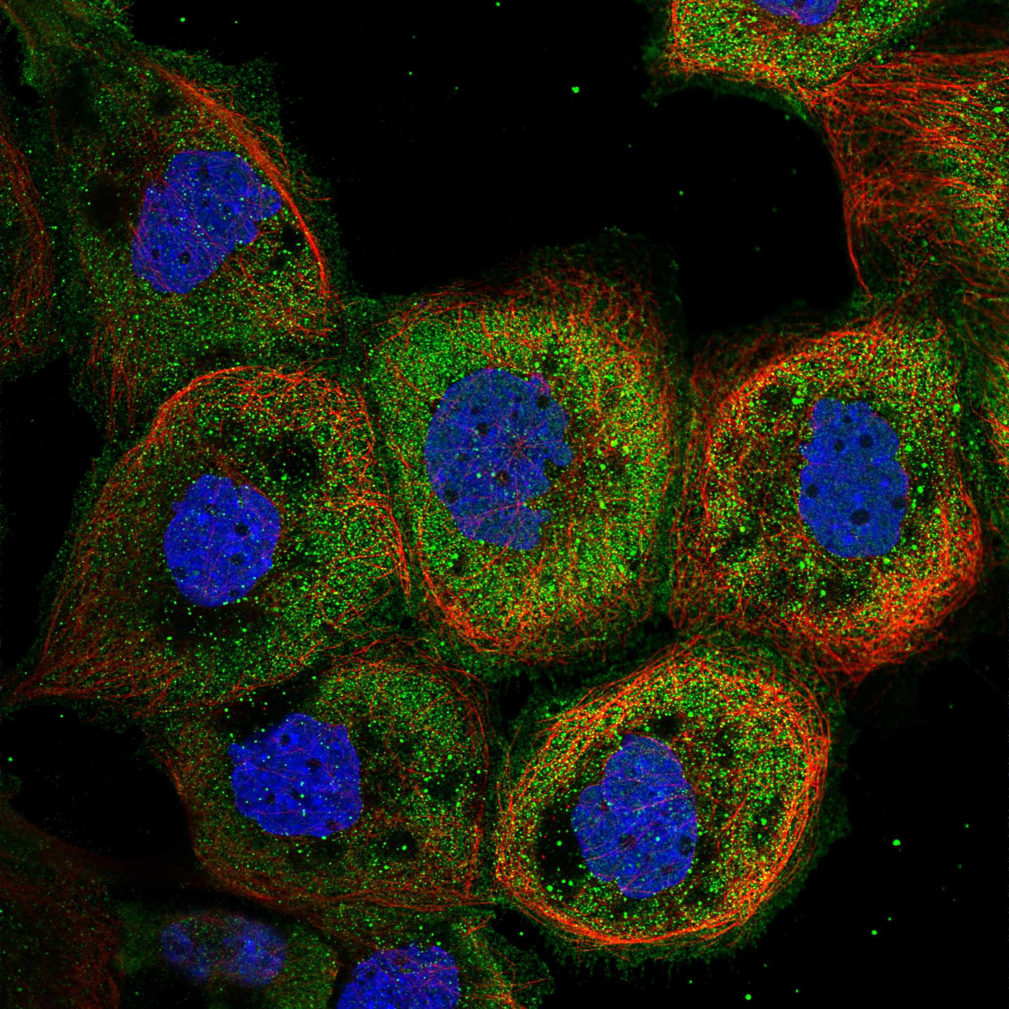 ASPM fluorescence