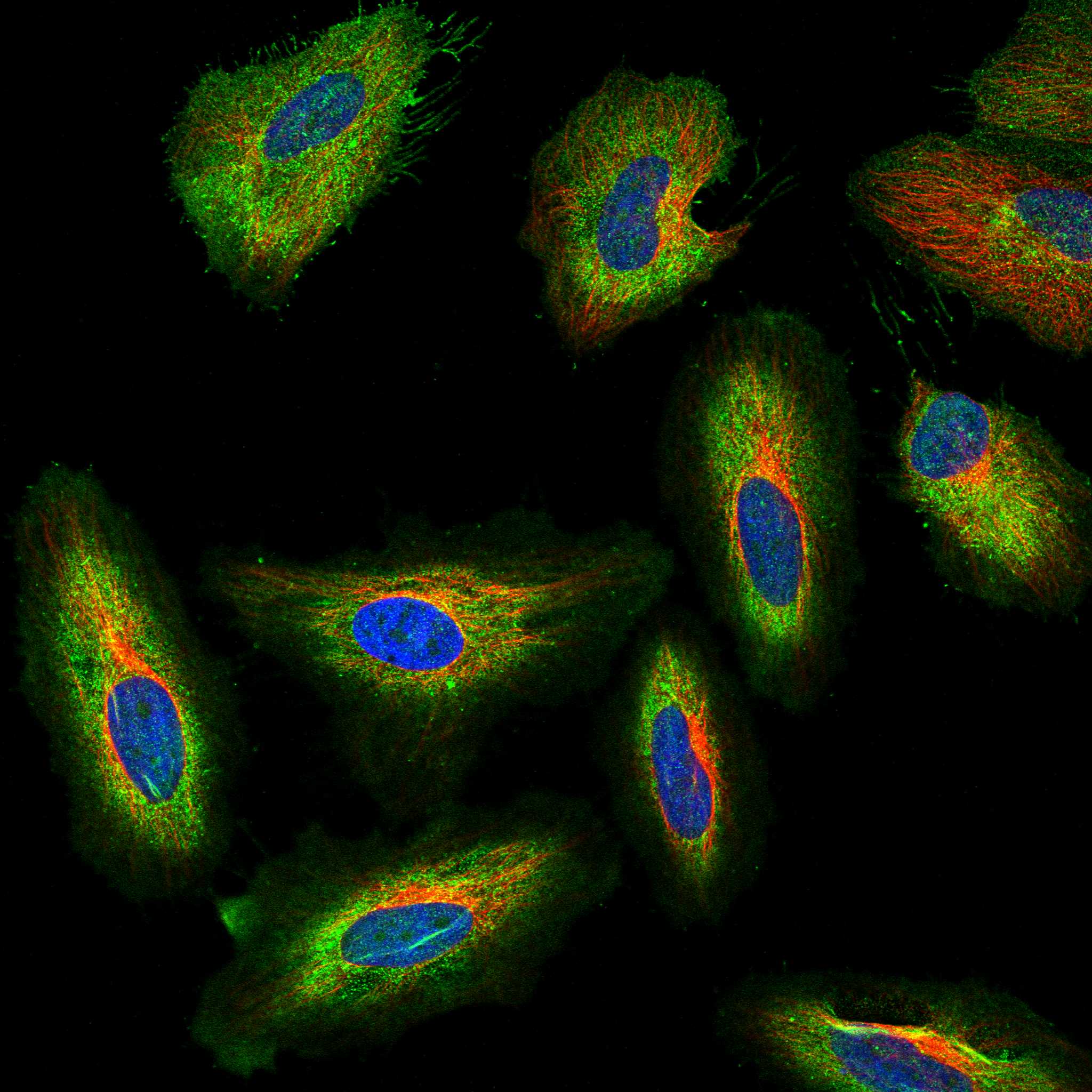 BASP1 fluorescence