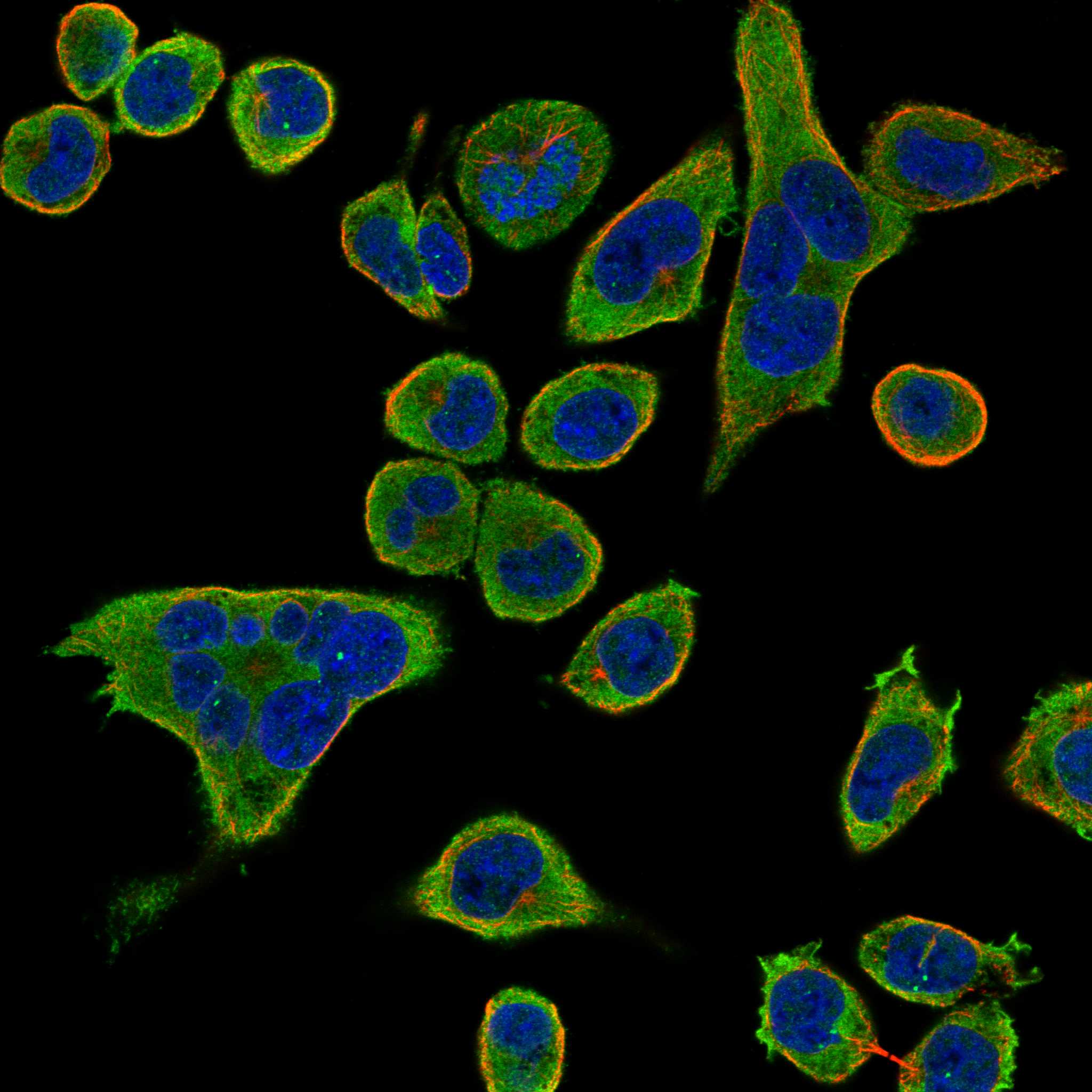 BTK fluorescence