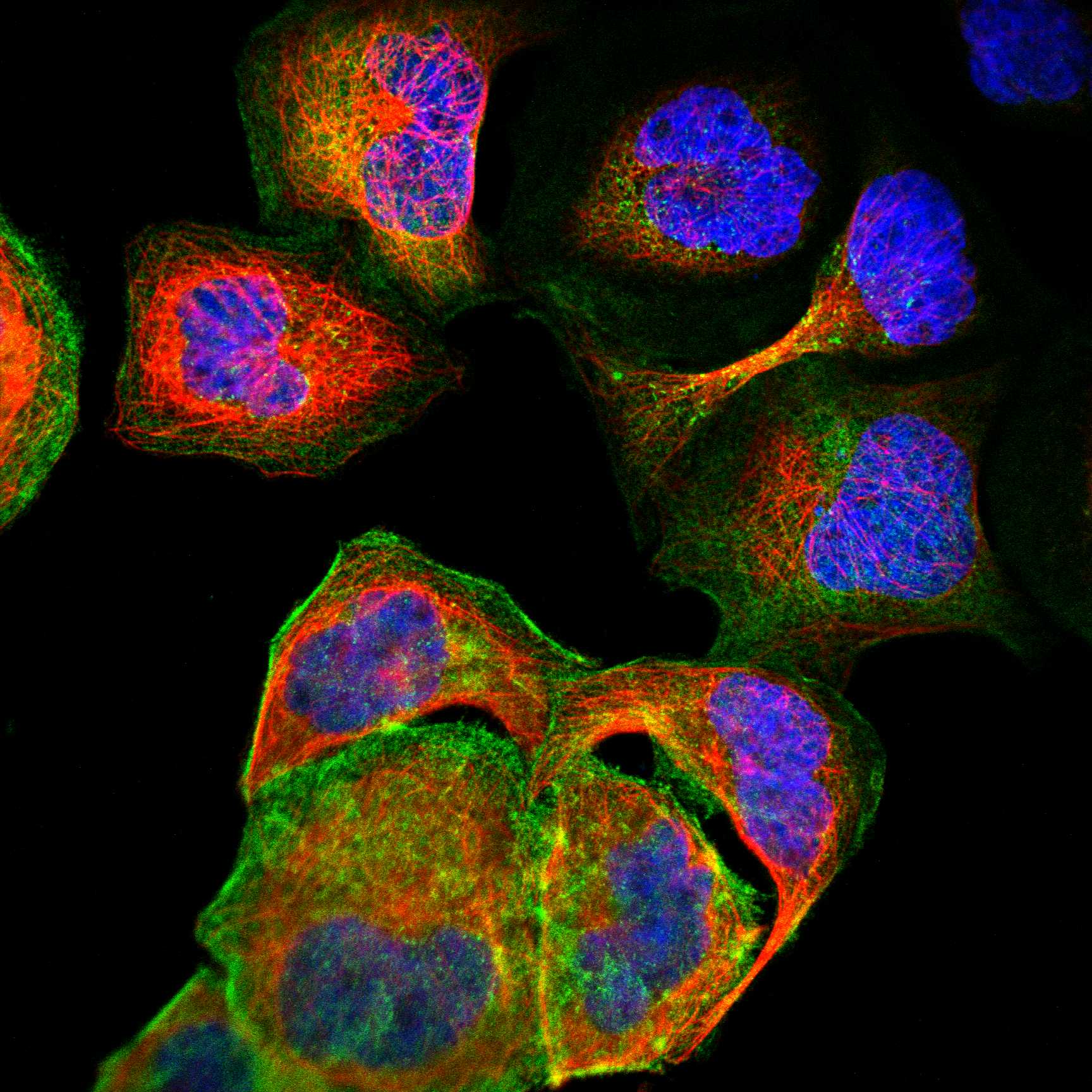 CALD1 fluorescence