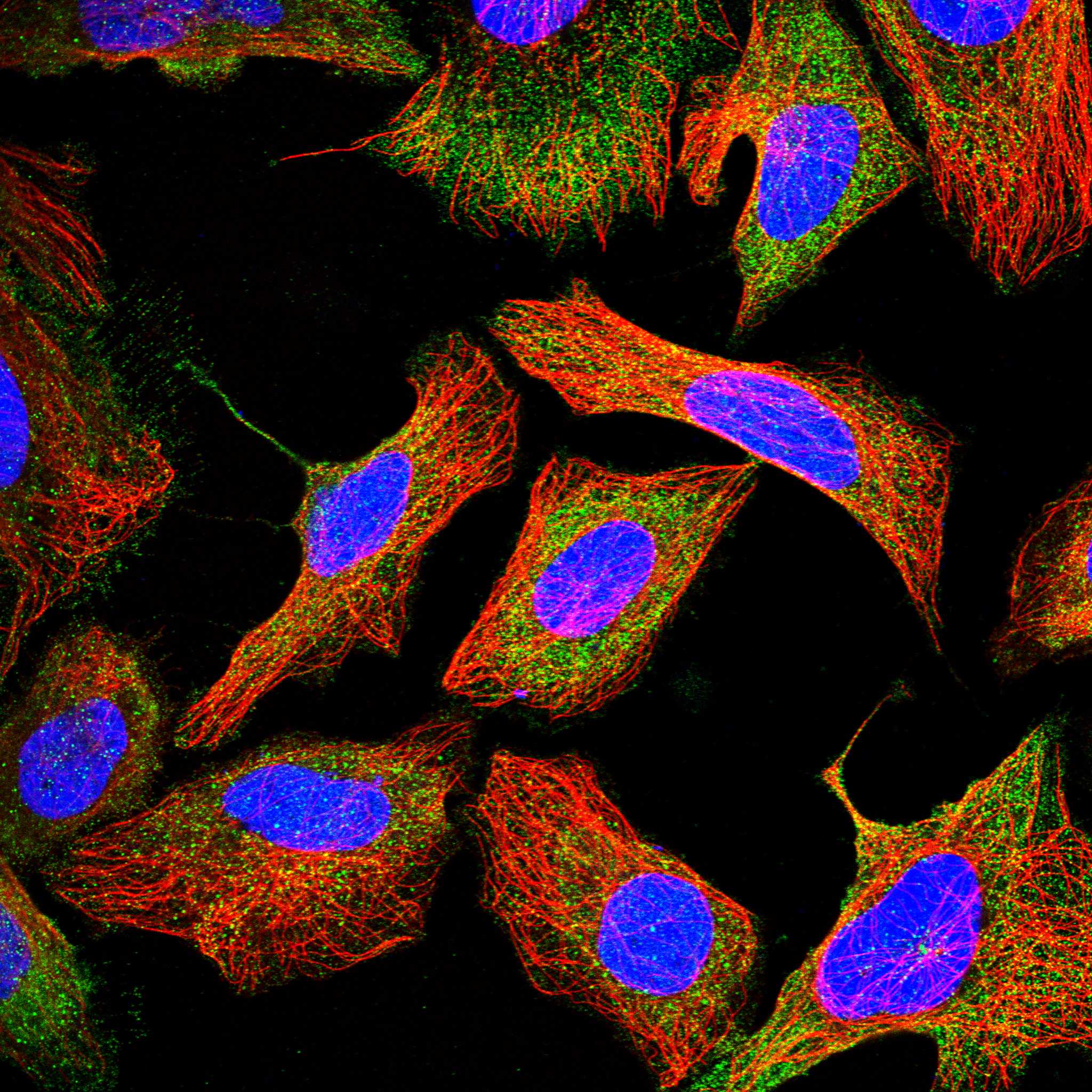 CCBE1 fluorescence