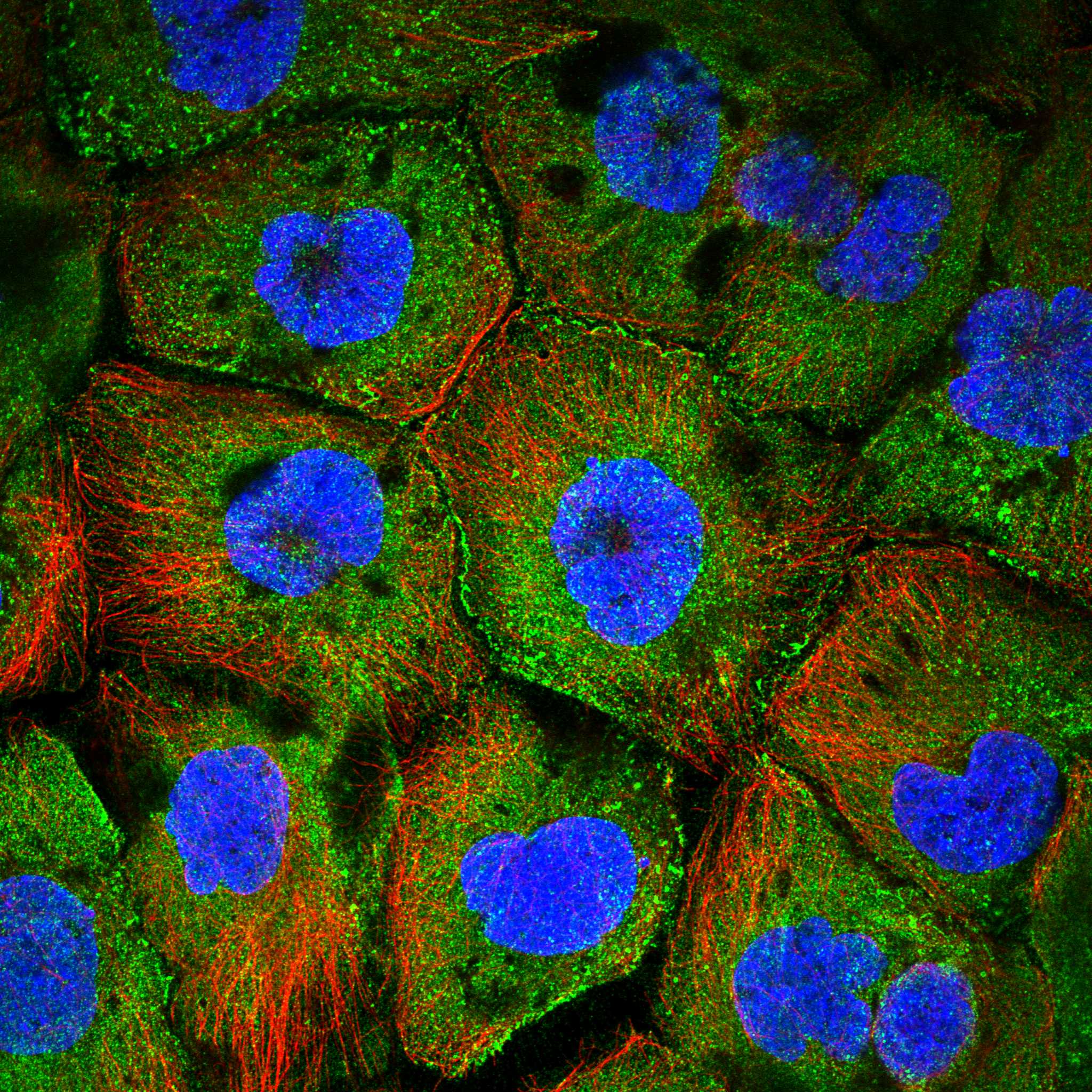 CCDC8 fluorescence