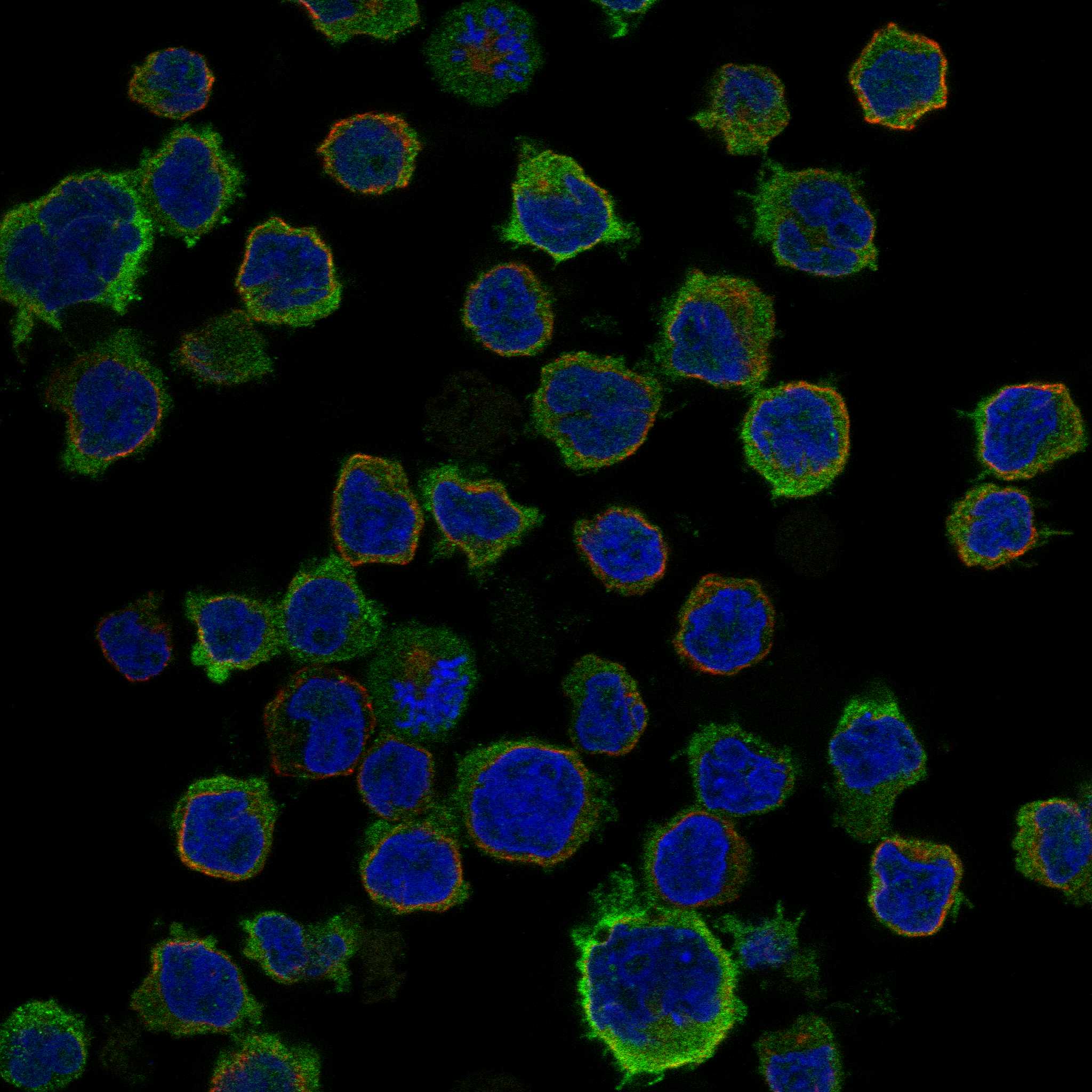 CCR2 fluorescence