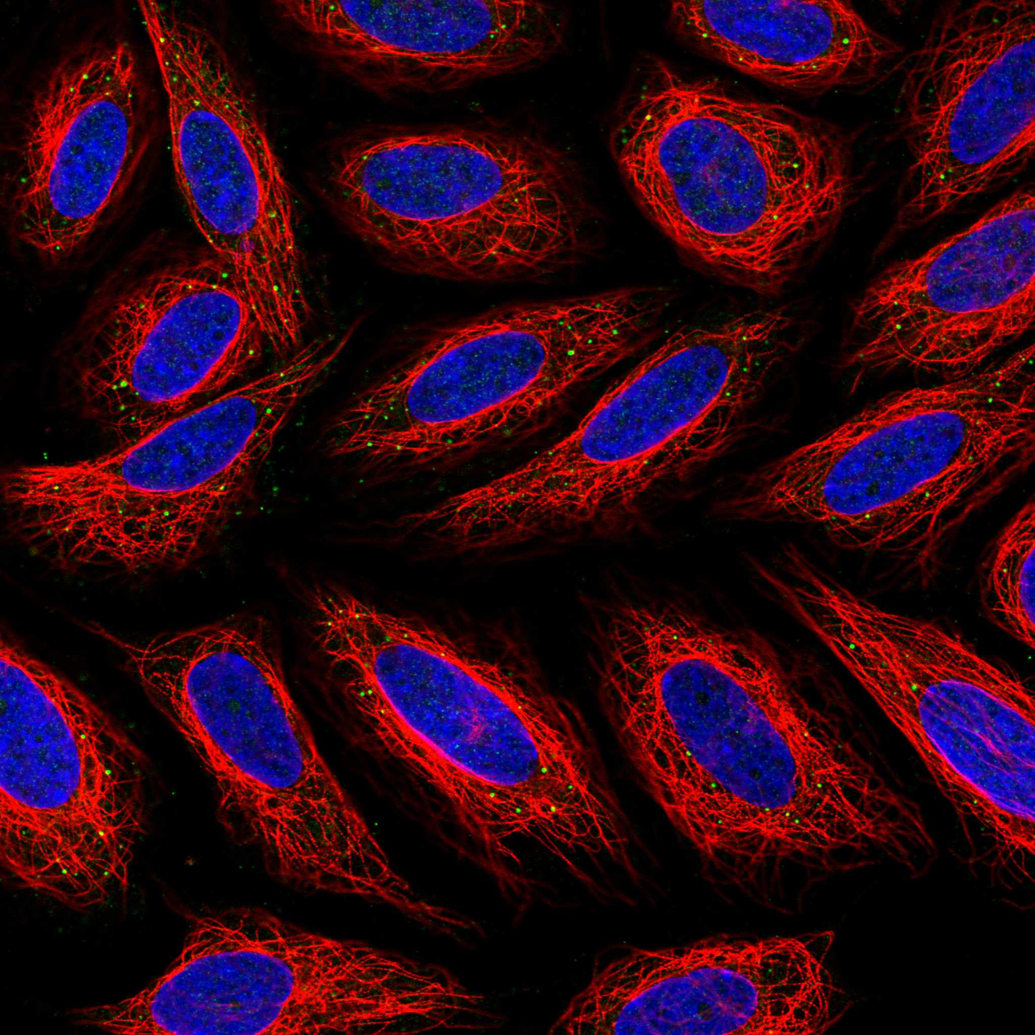 CD14 fluorescence