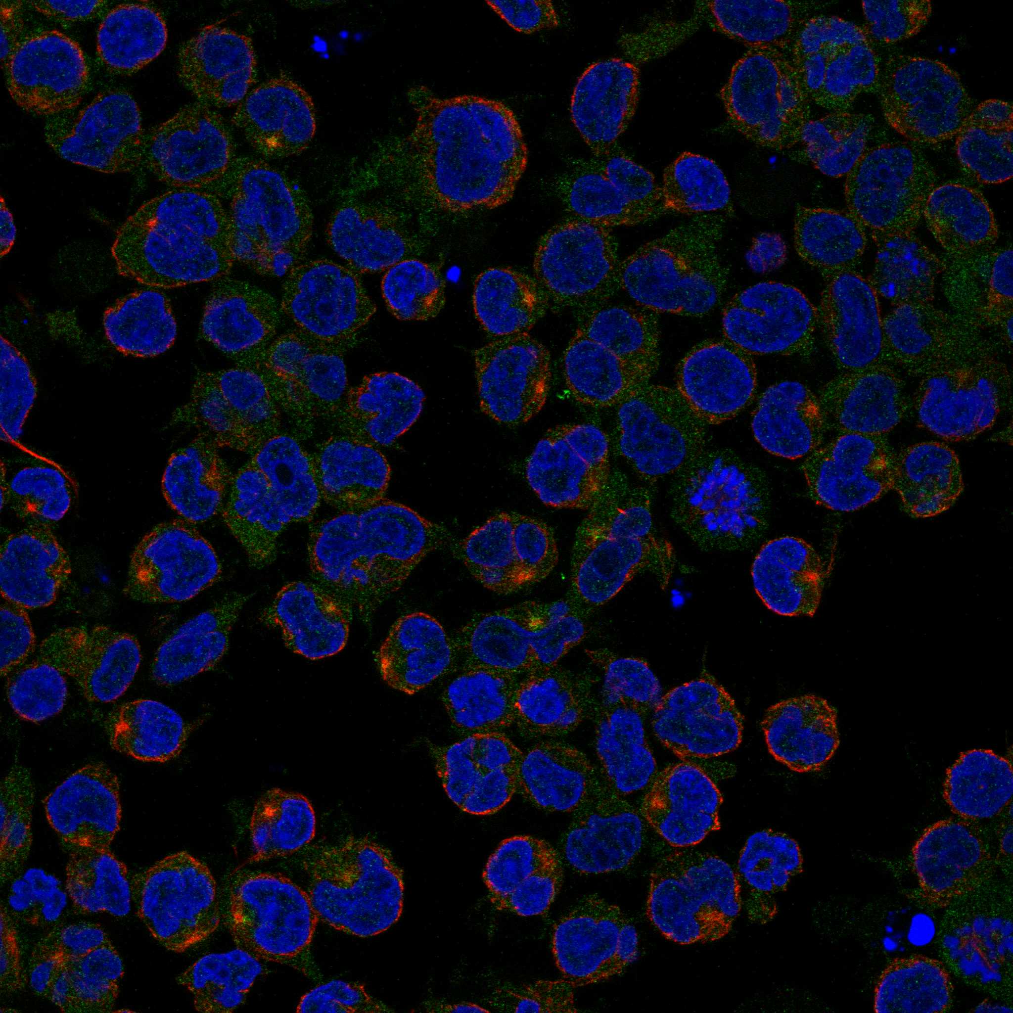 CD1B fluorescence