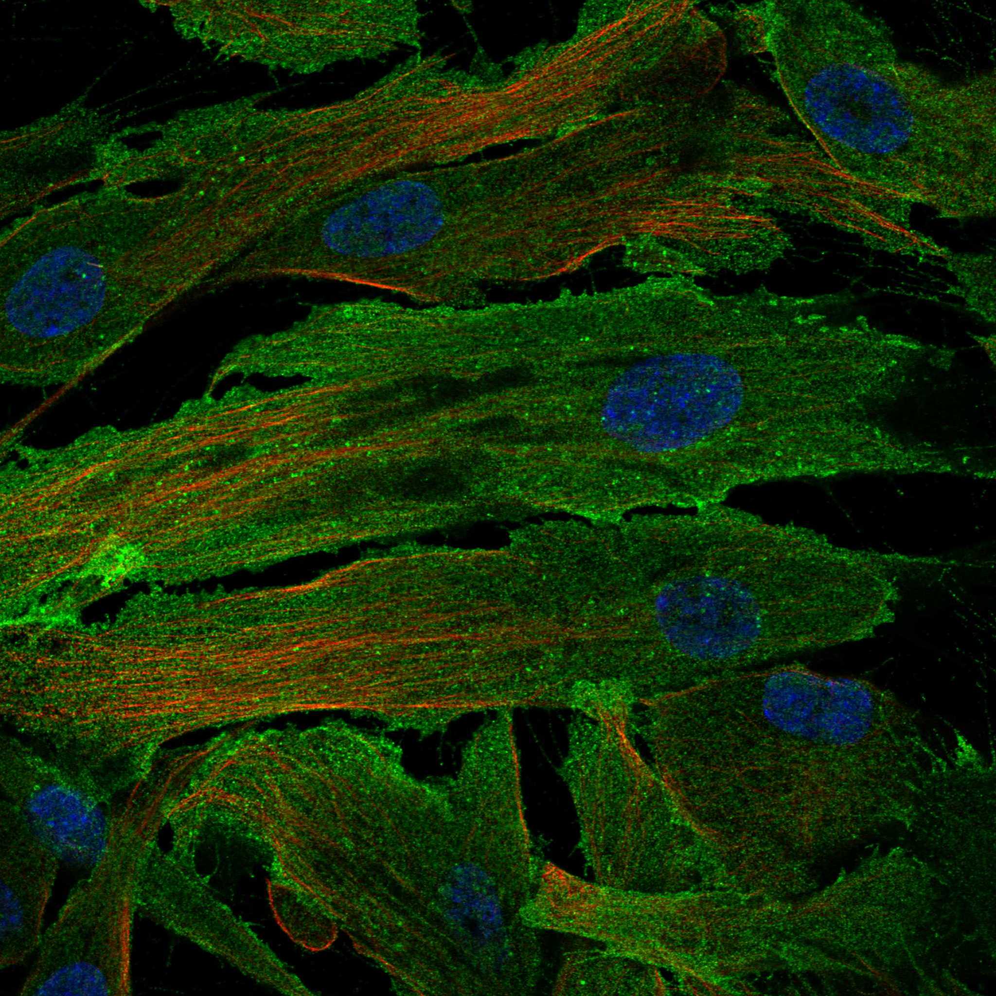 CD248 fluorescence