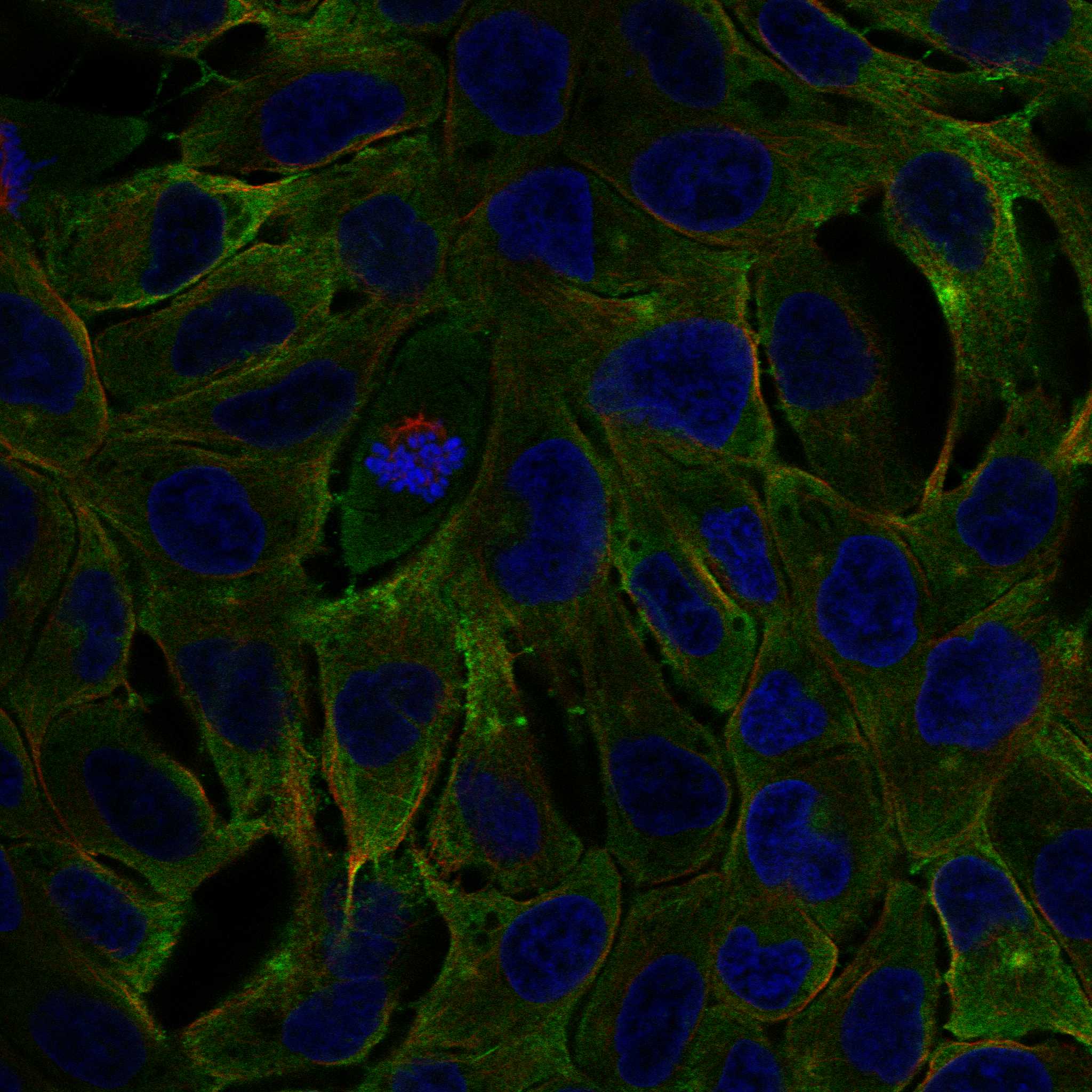 CD2AP fluorescence