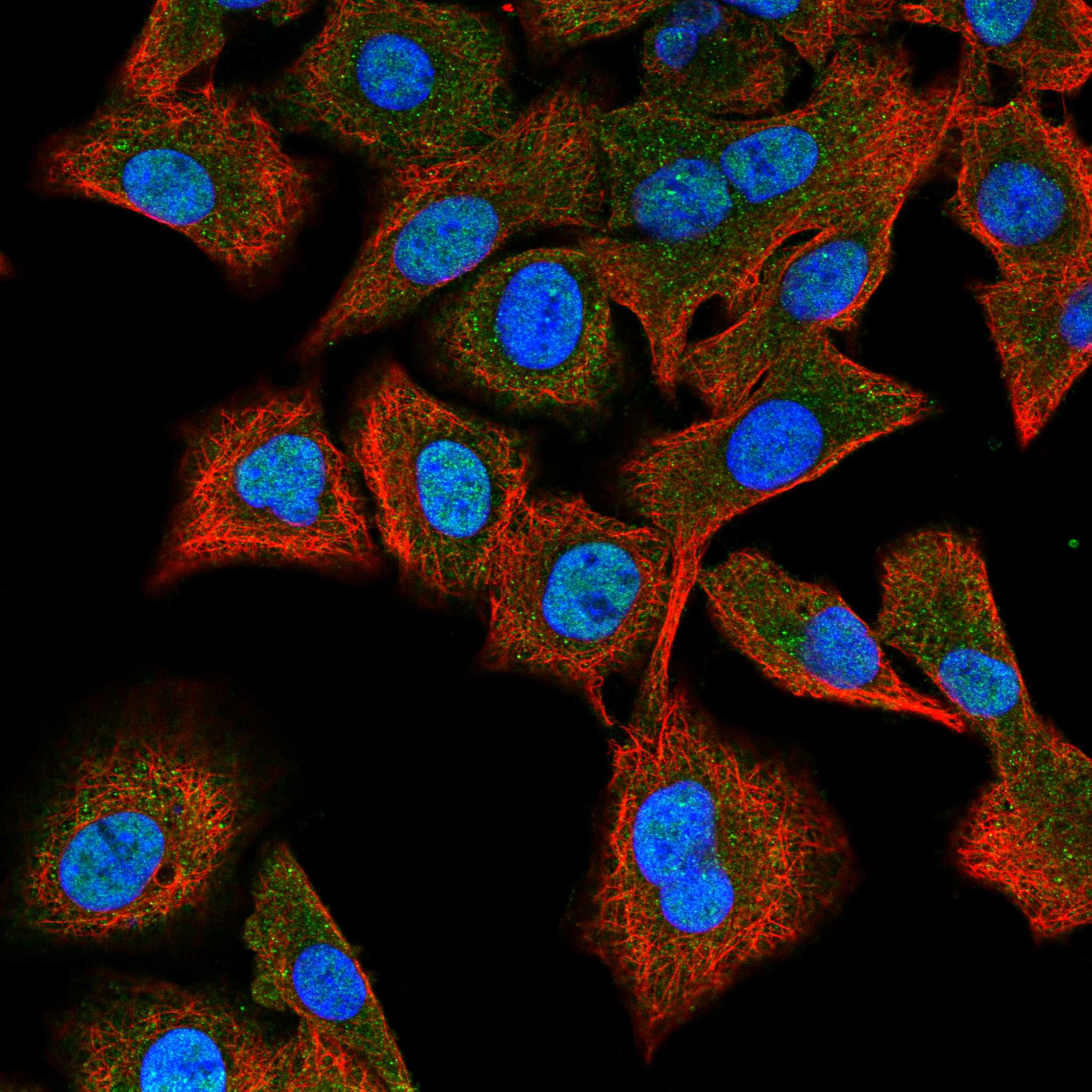 CIB1 fluorescence
