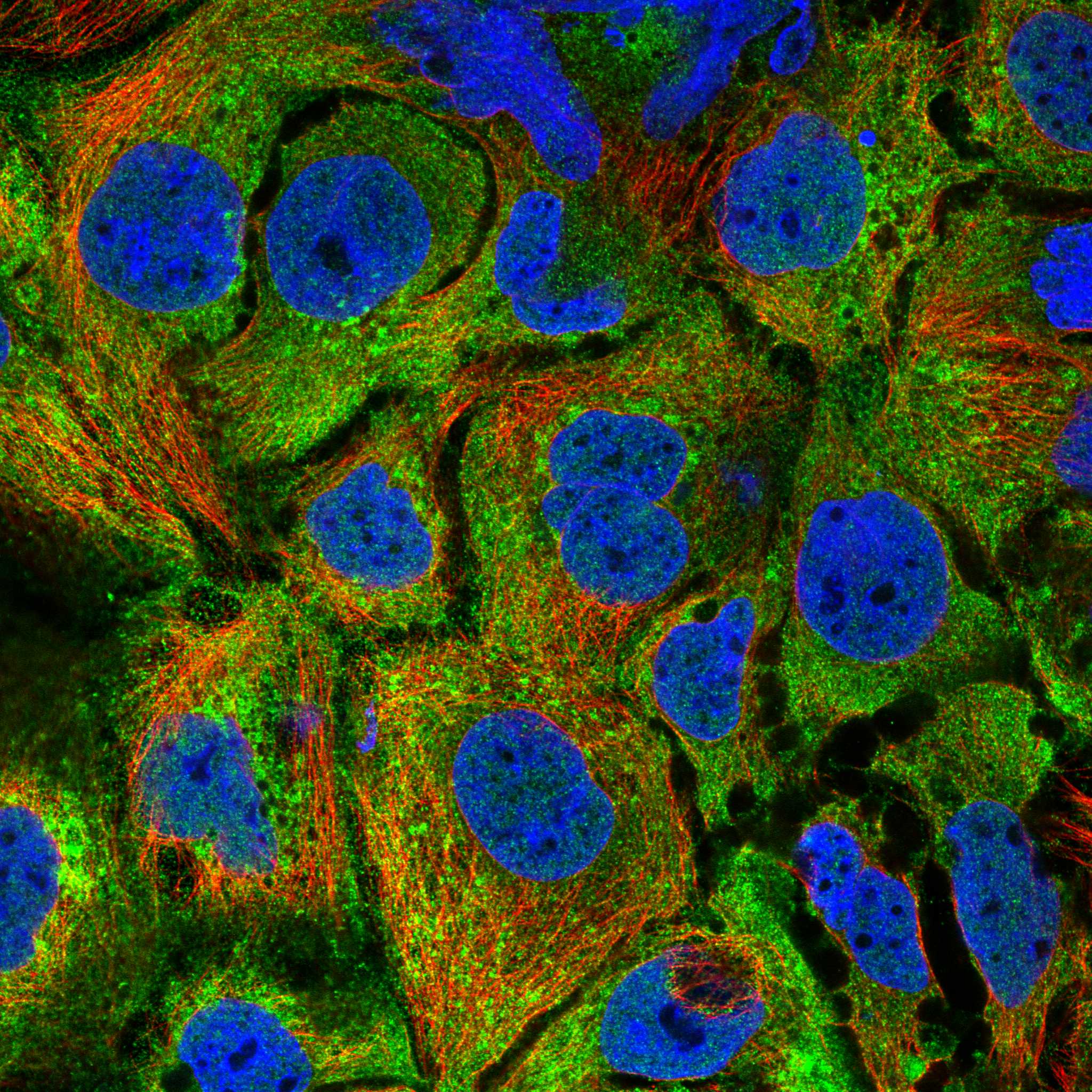 CLCN5 fluorescence