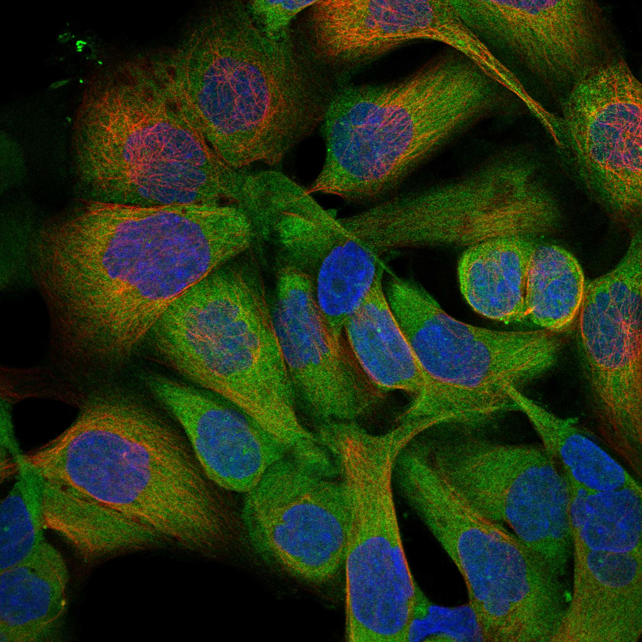 CLIC4 fluorescence