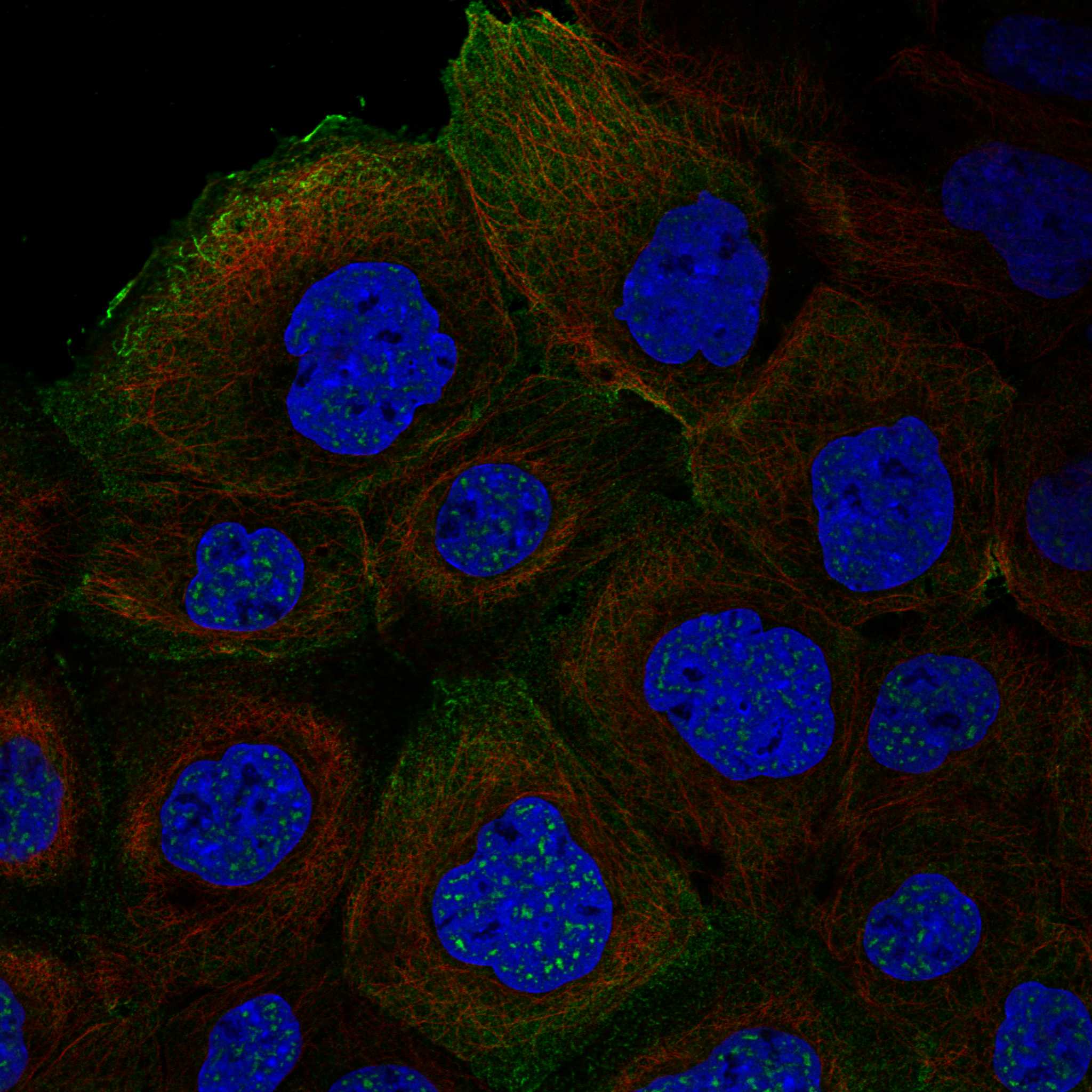 CLIC5 fluorescence