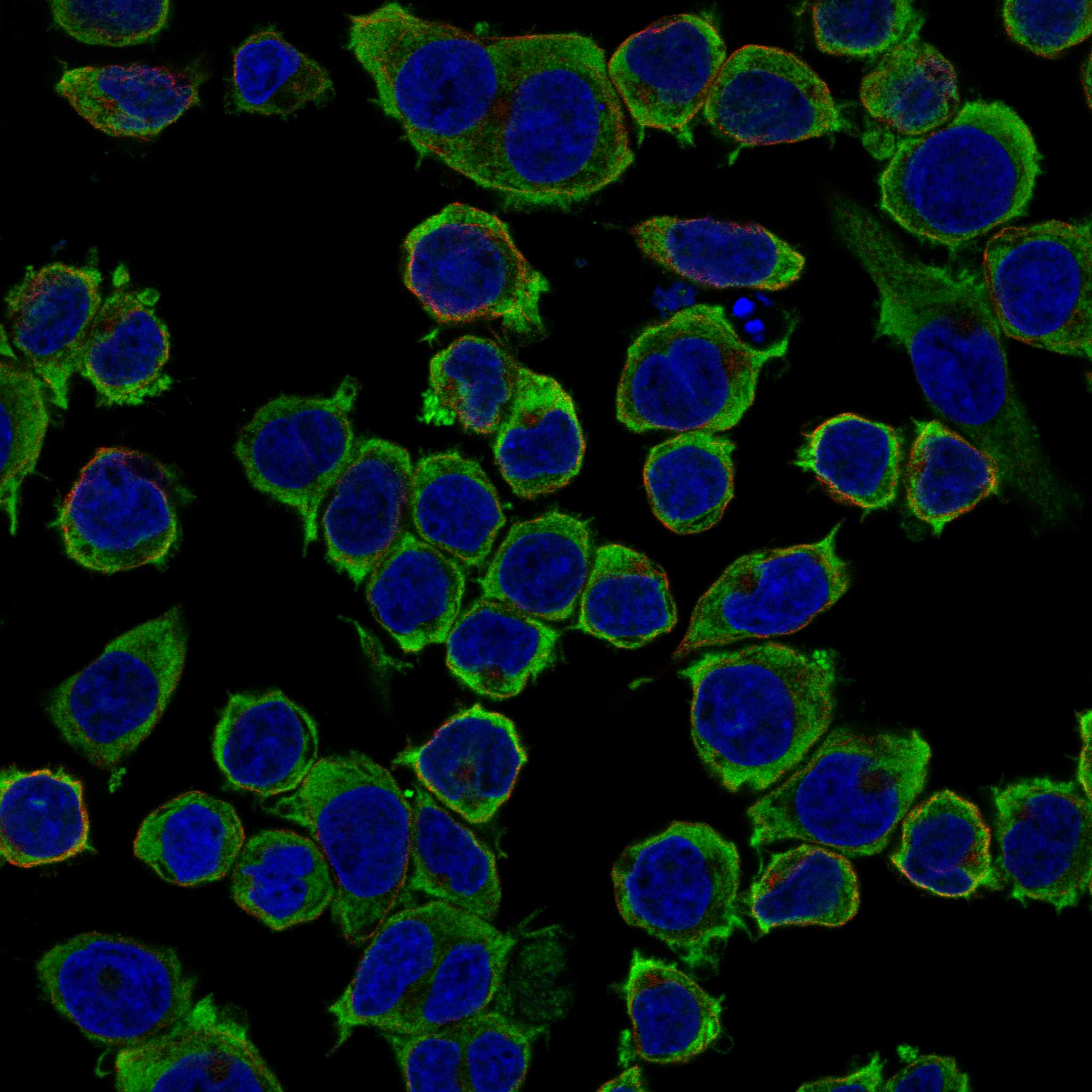 CR1 fluorescence
