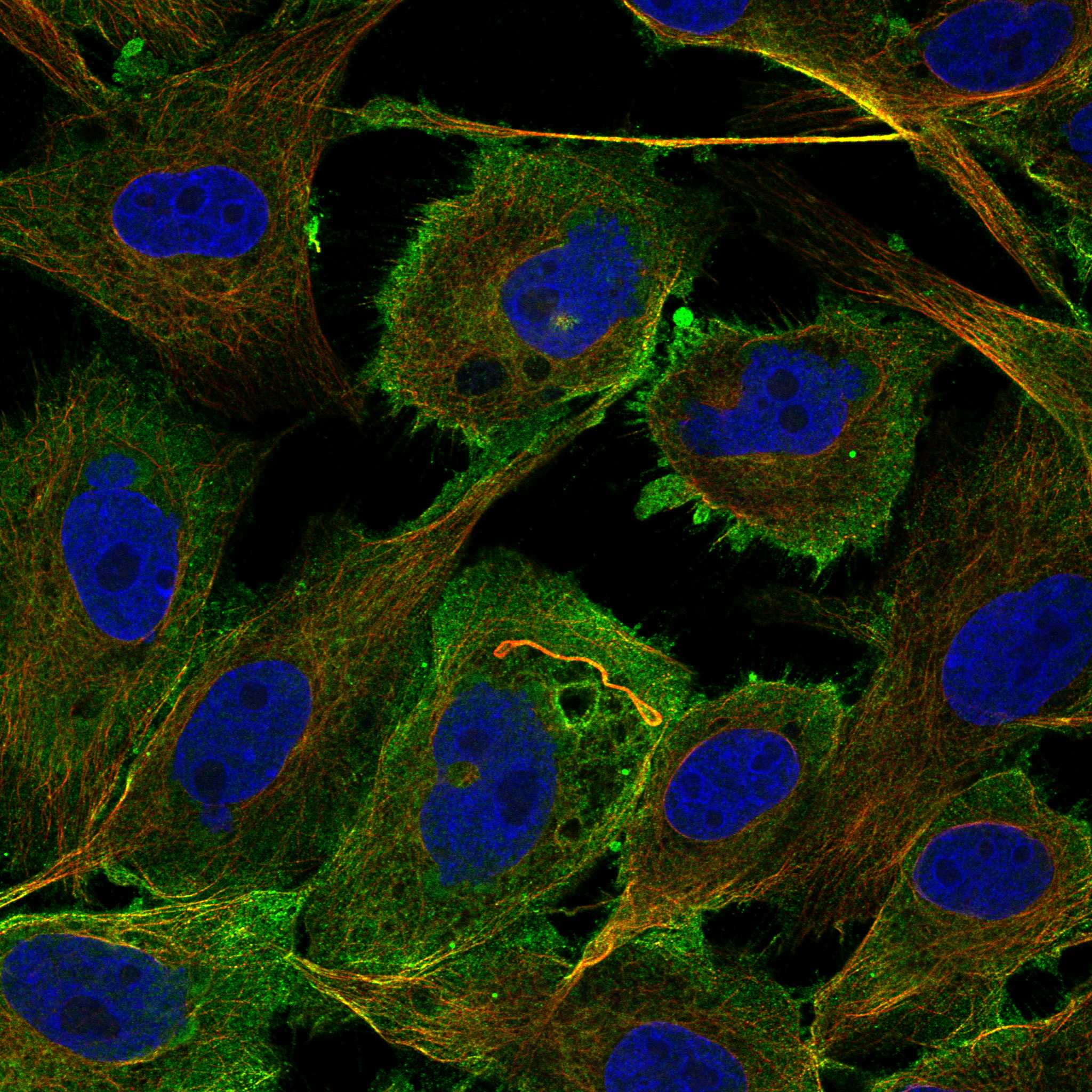 CRLF2 fluorescence