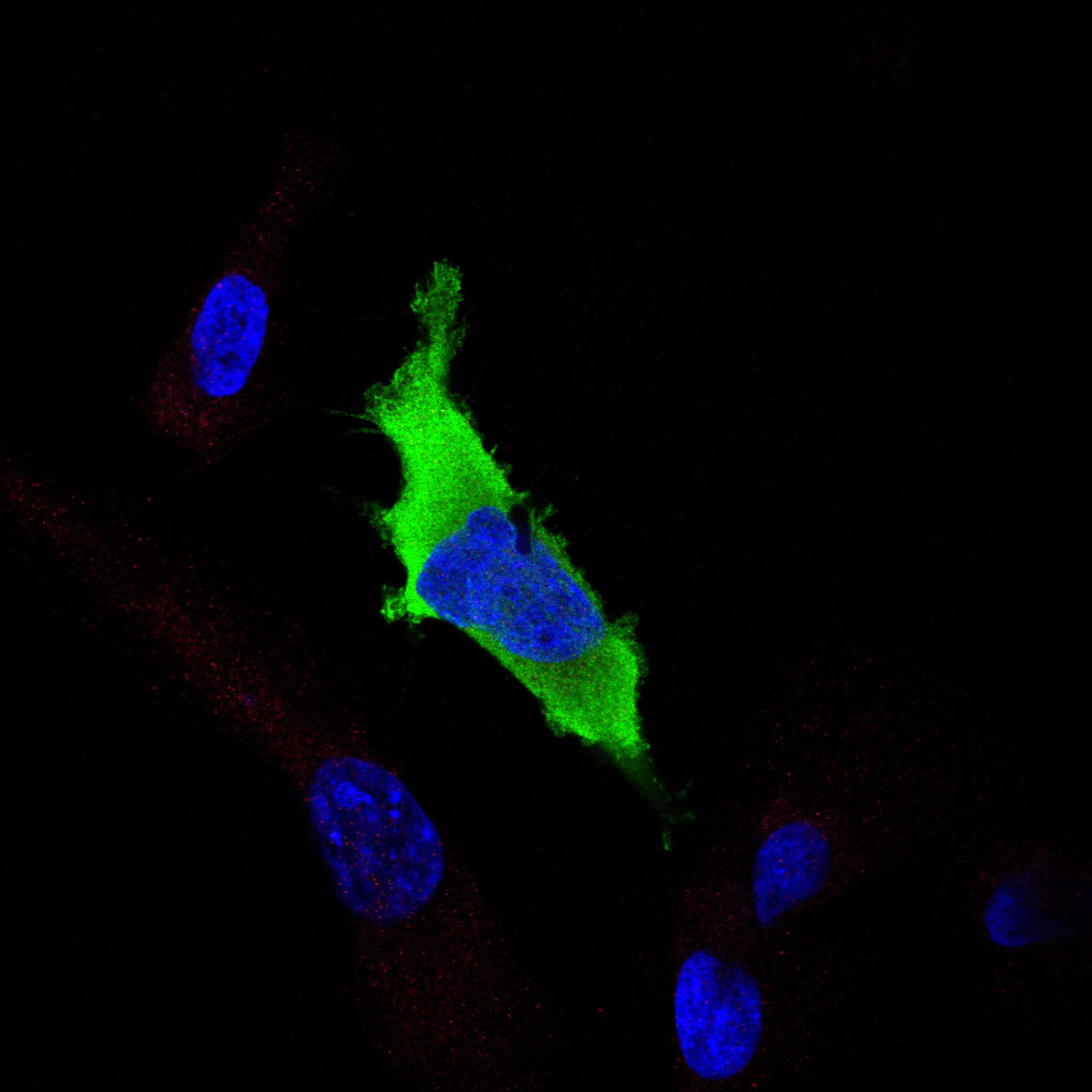 CRYAB fluorescence