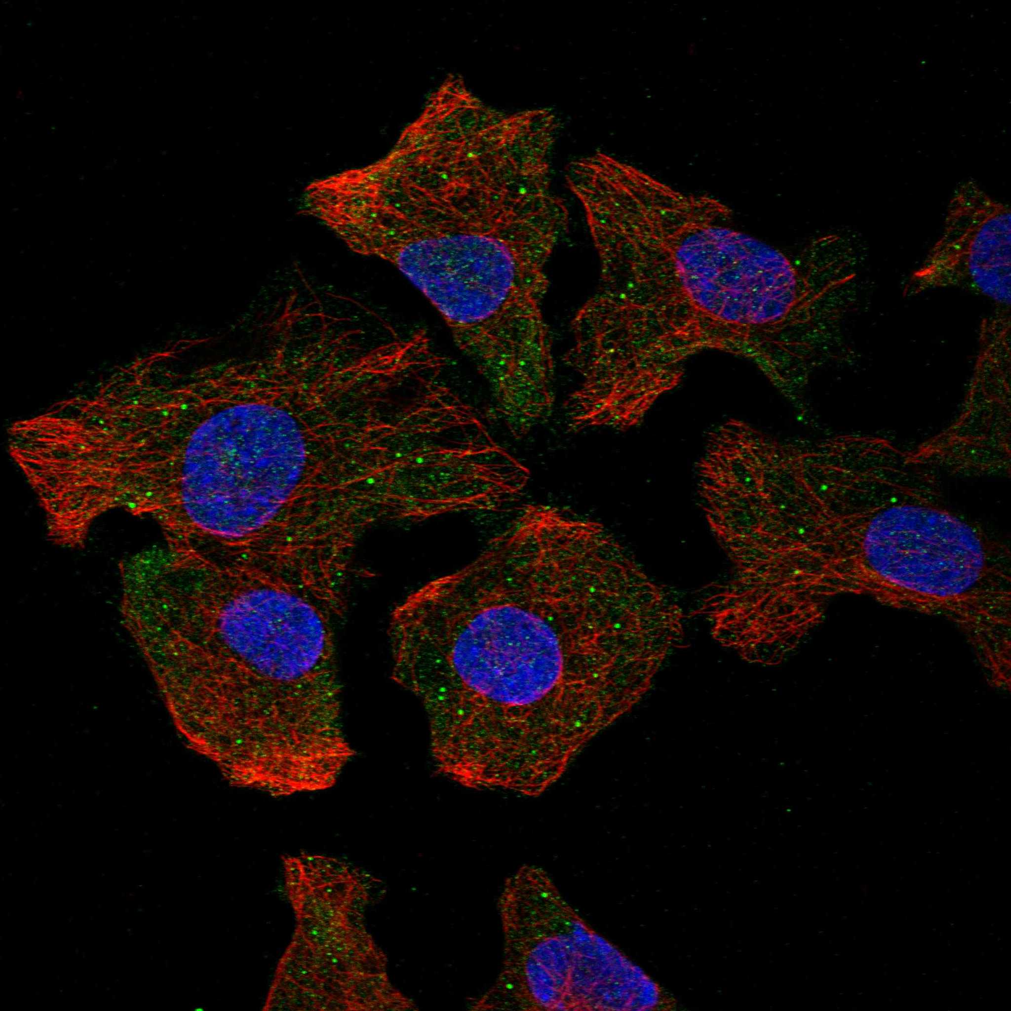 CTNS fluorescence