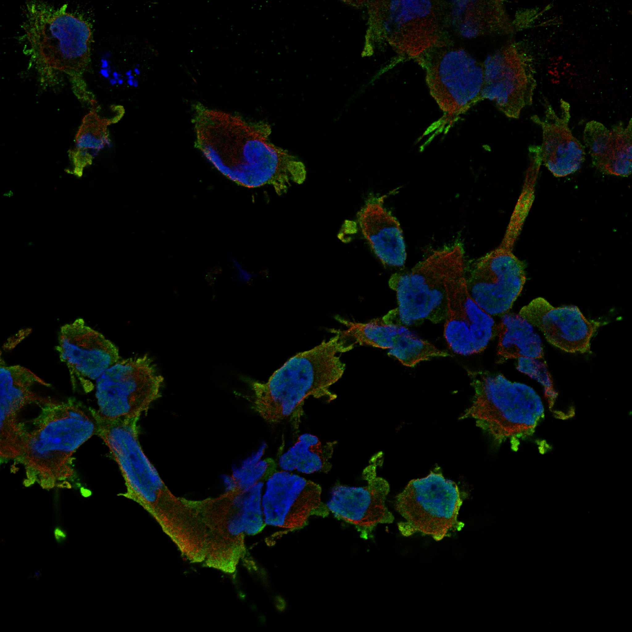 DGKB fluorescence