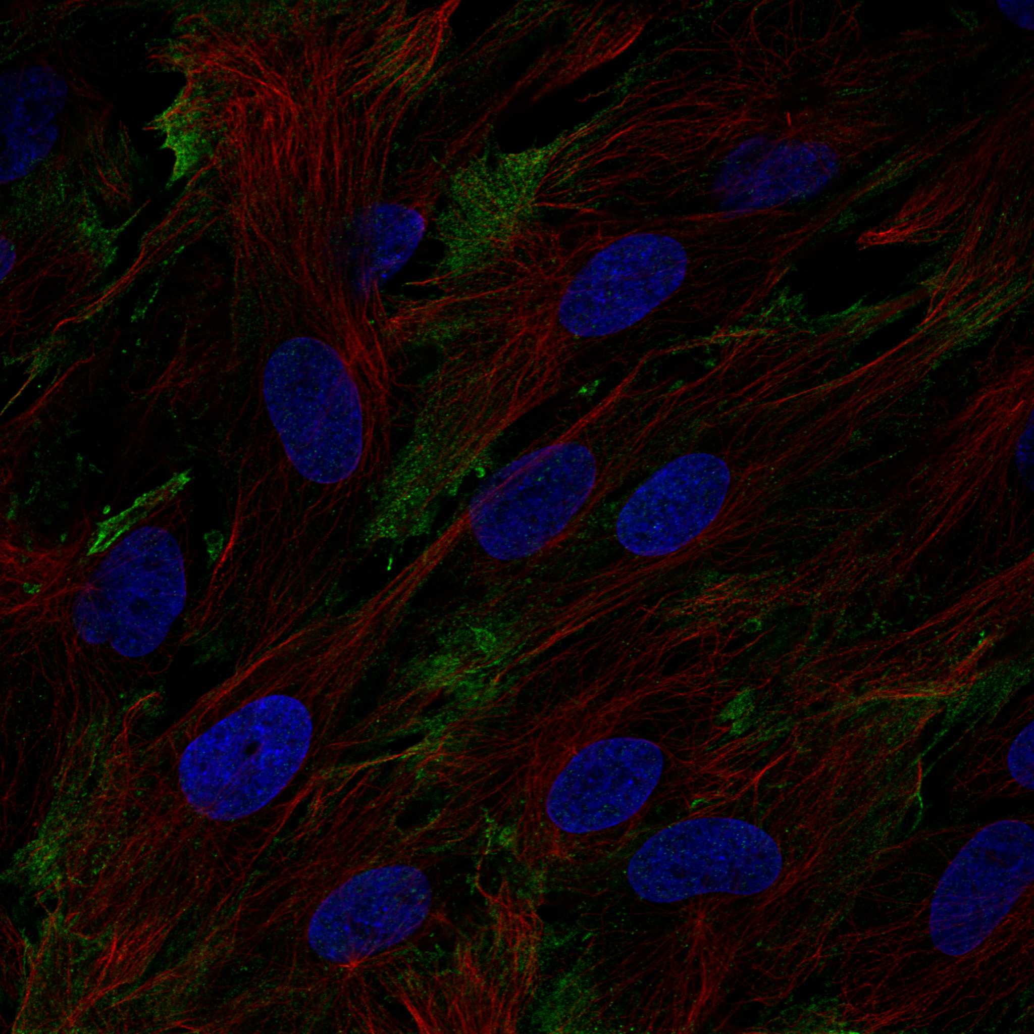 DSEL fluorescence