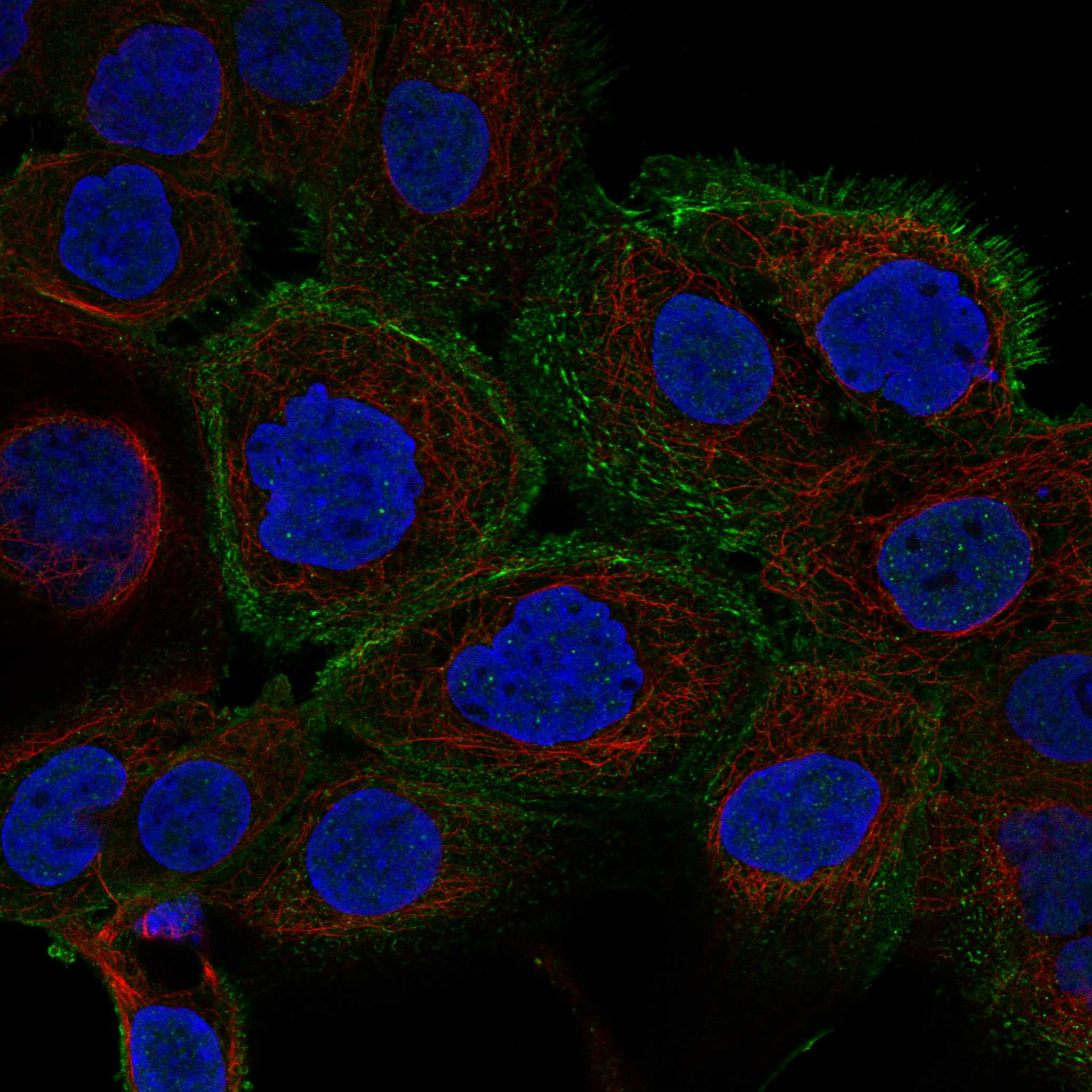 DVL1 fluorescence