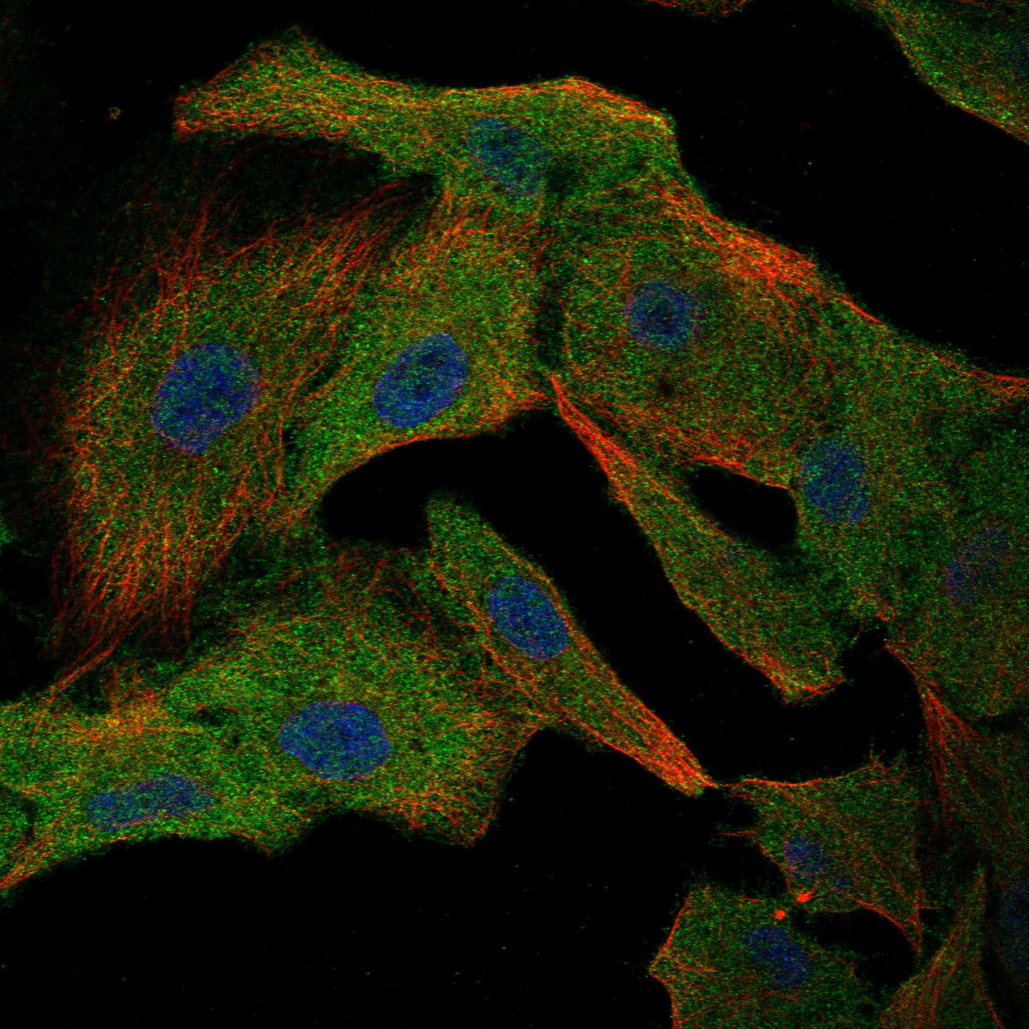 EHBP1 fluorescence