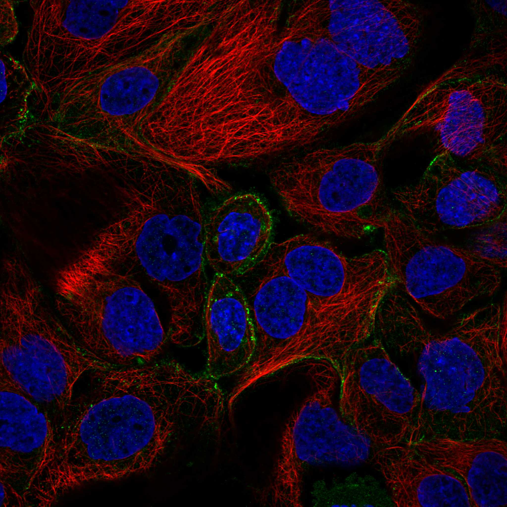 EHD1 fluorescence