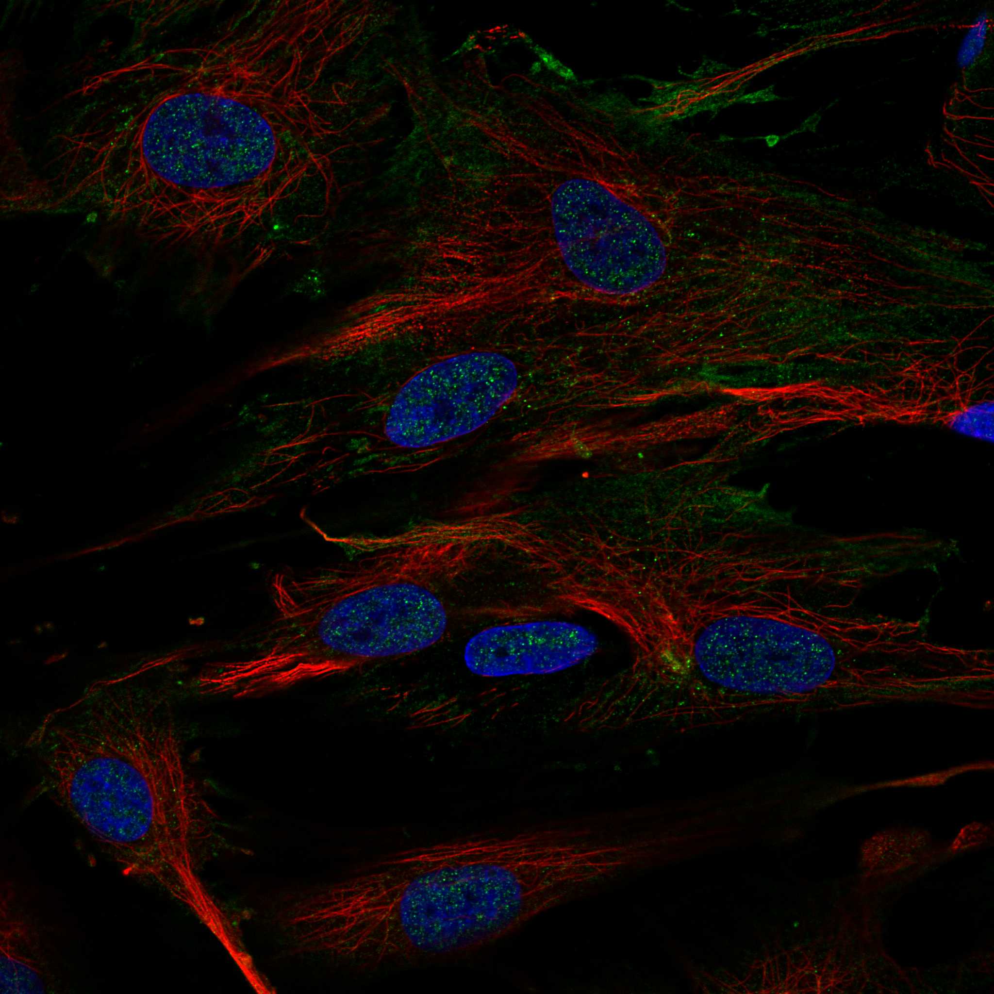 ELN fluorescence