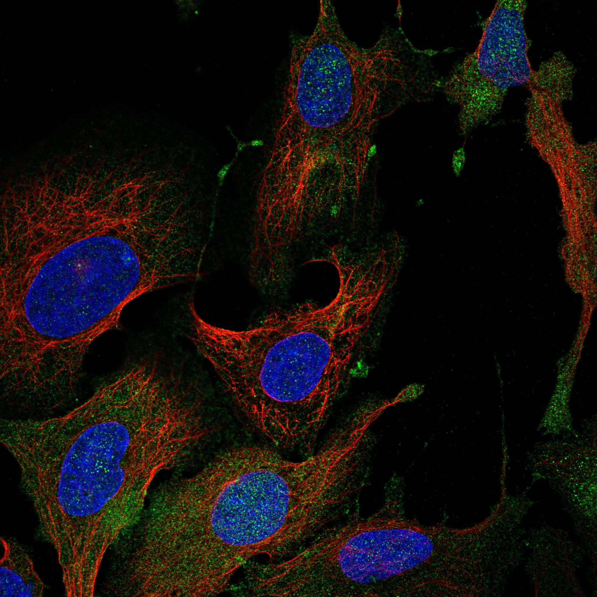 EPB41 fluorescence