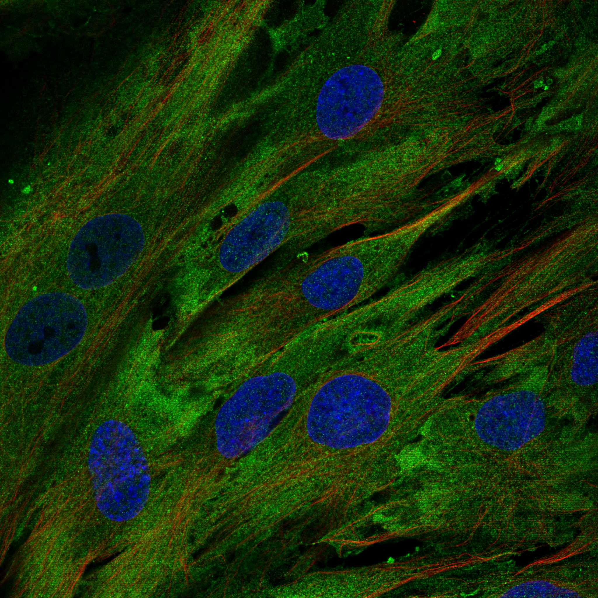 EPHB1 fluorescence
