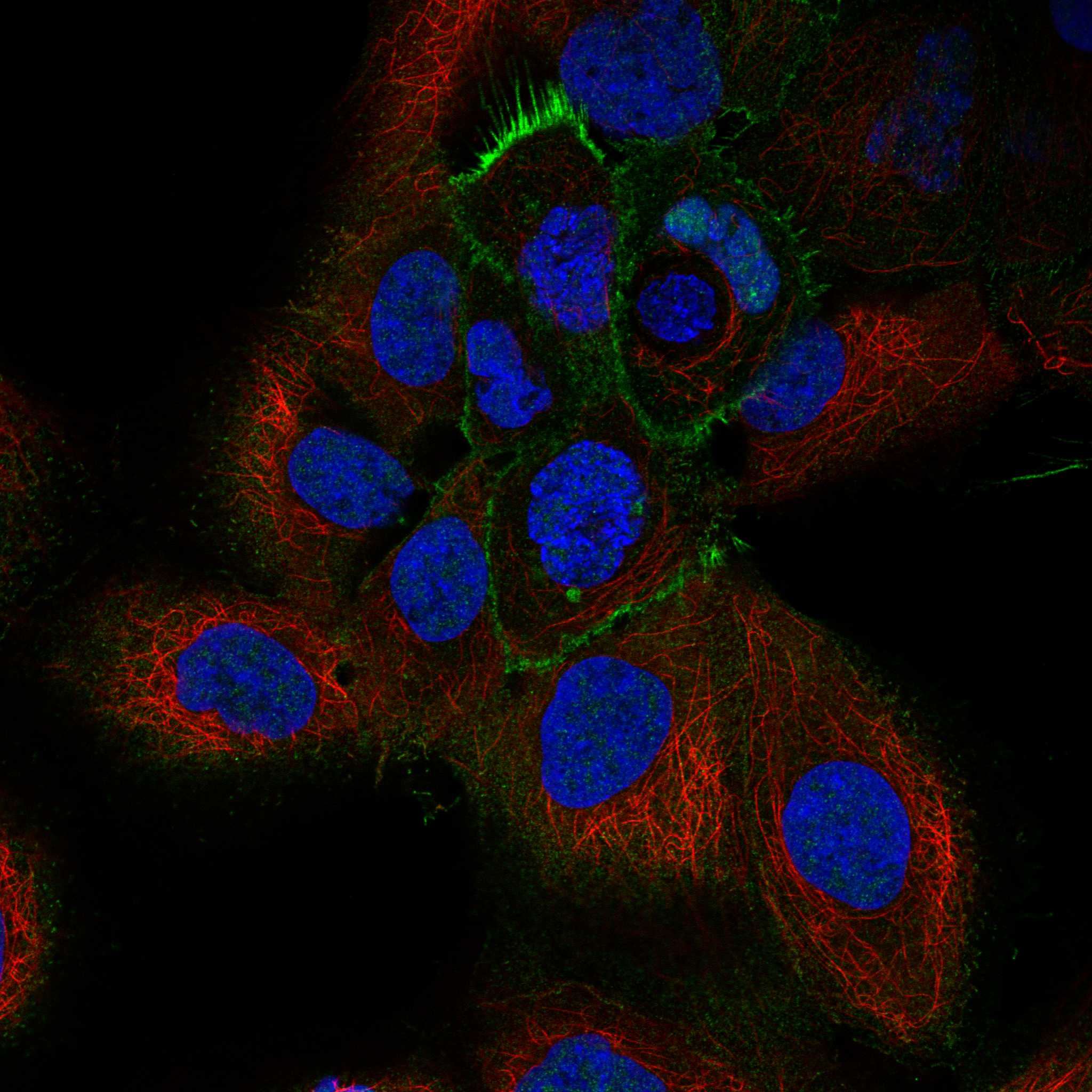 EPHB2 fluorescence