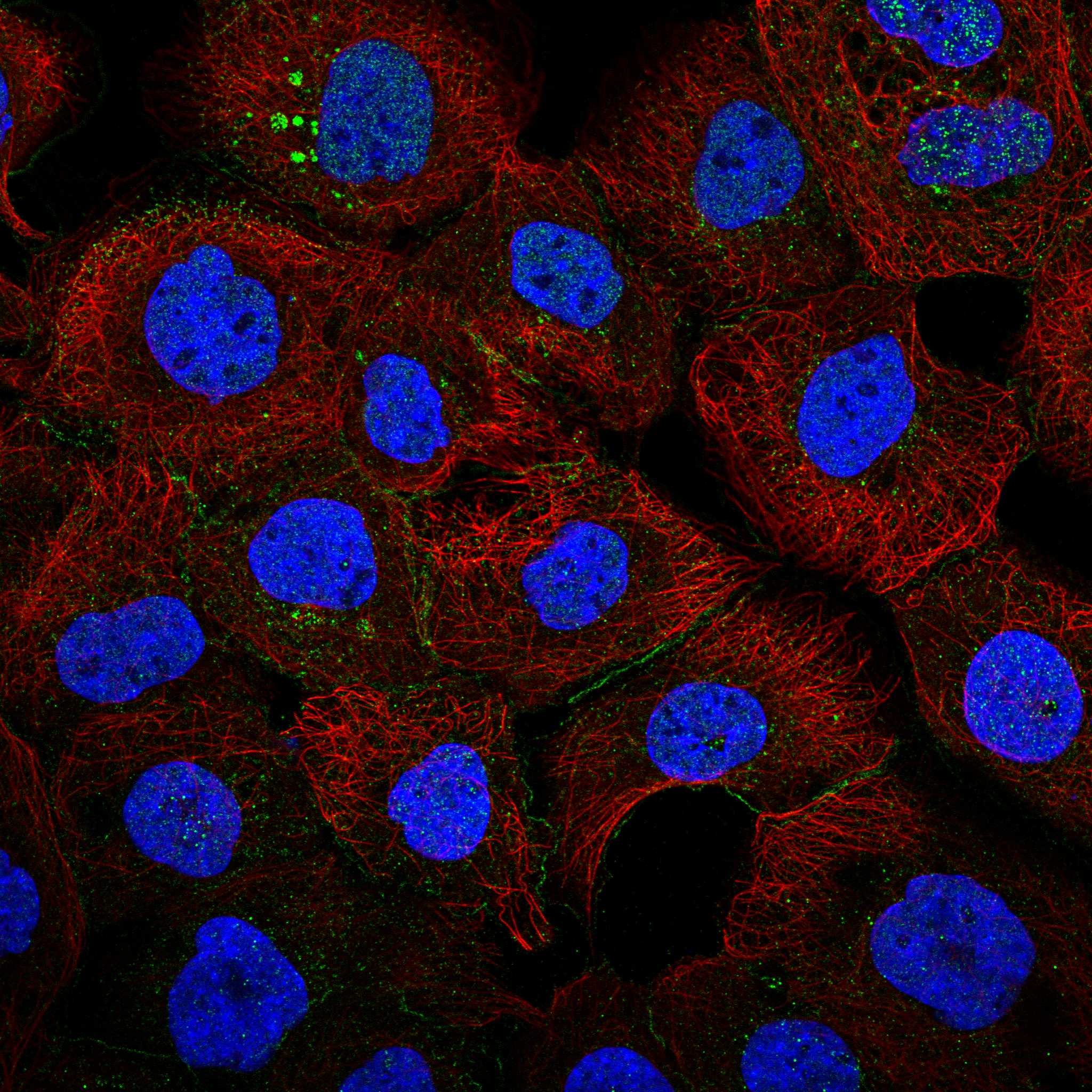 EPS8 fluorescence