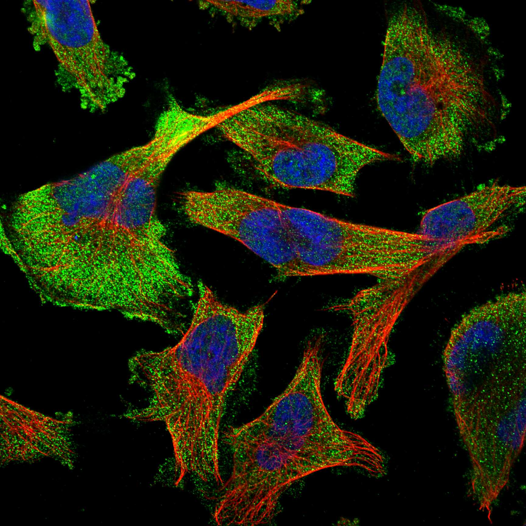 ERBB2 fluorescence