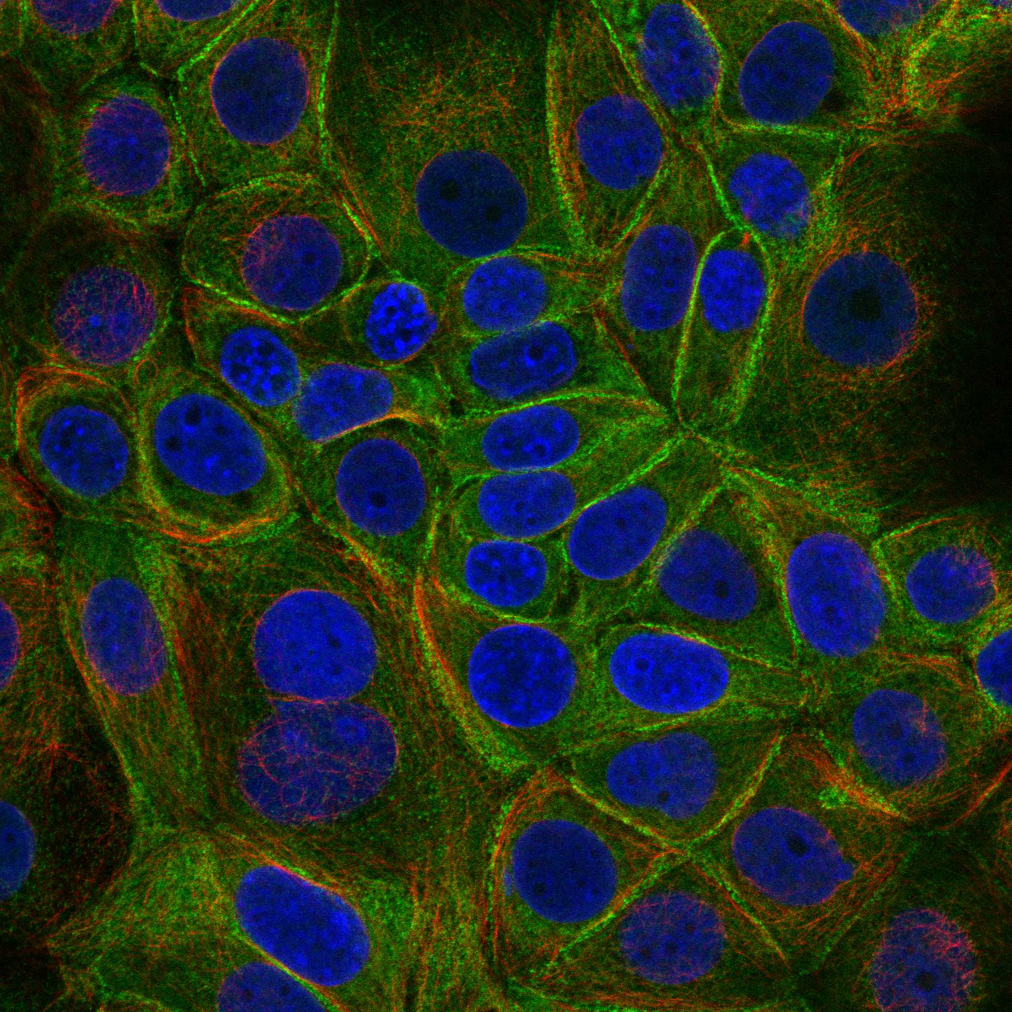 ESYT2 fluorescence