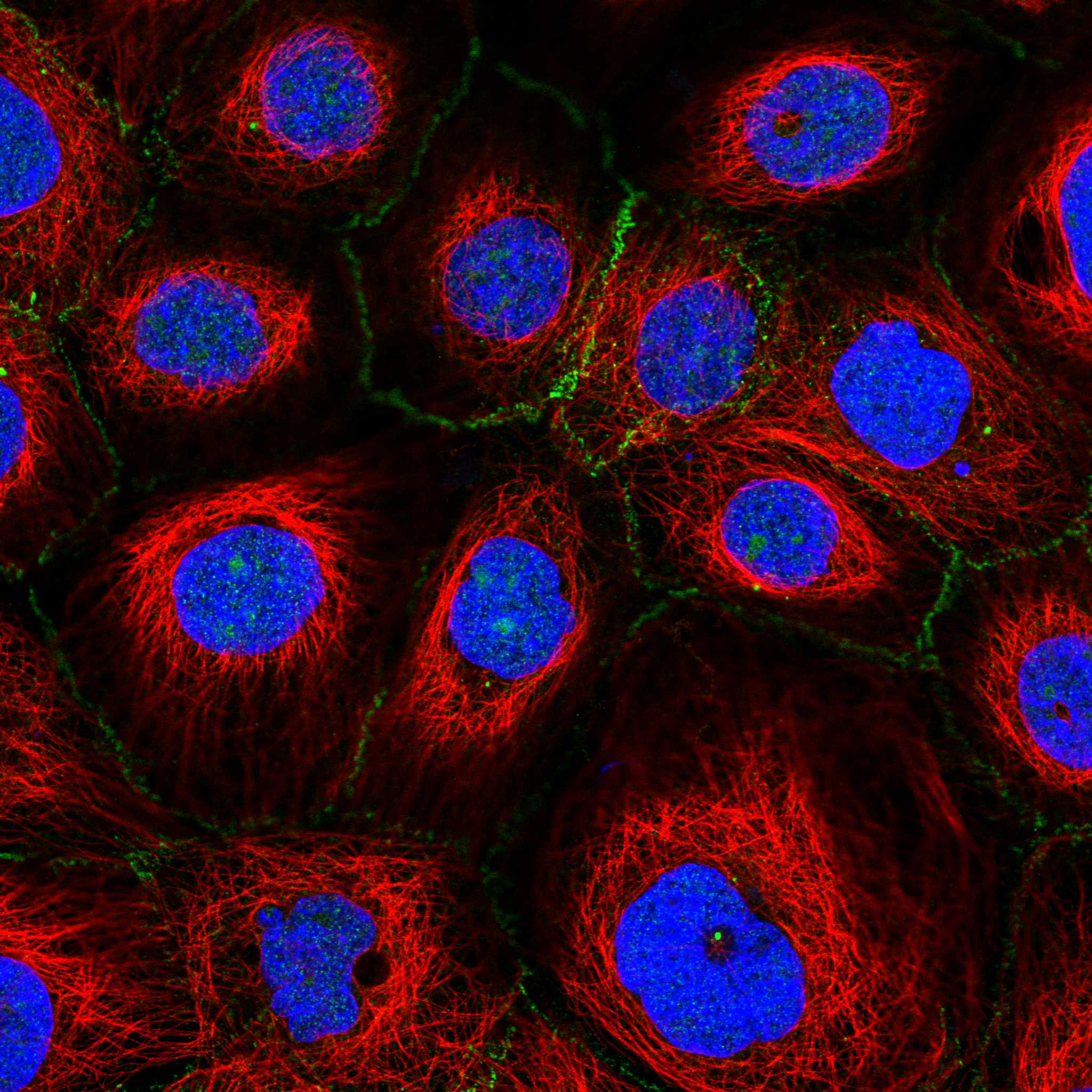 FBXL2 fluorescence