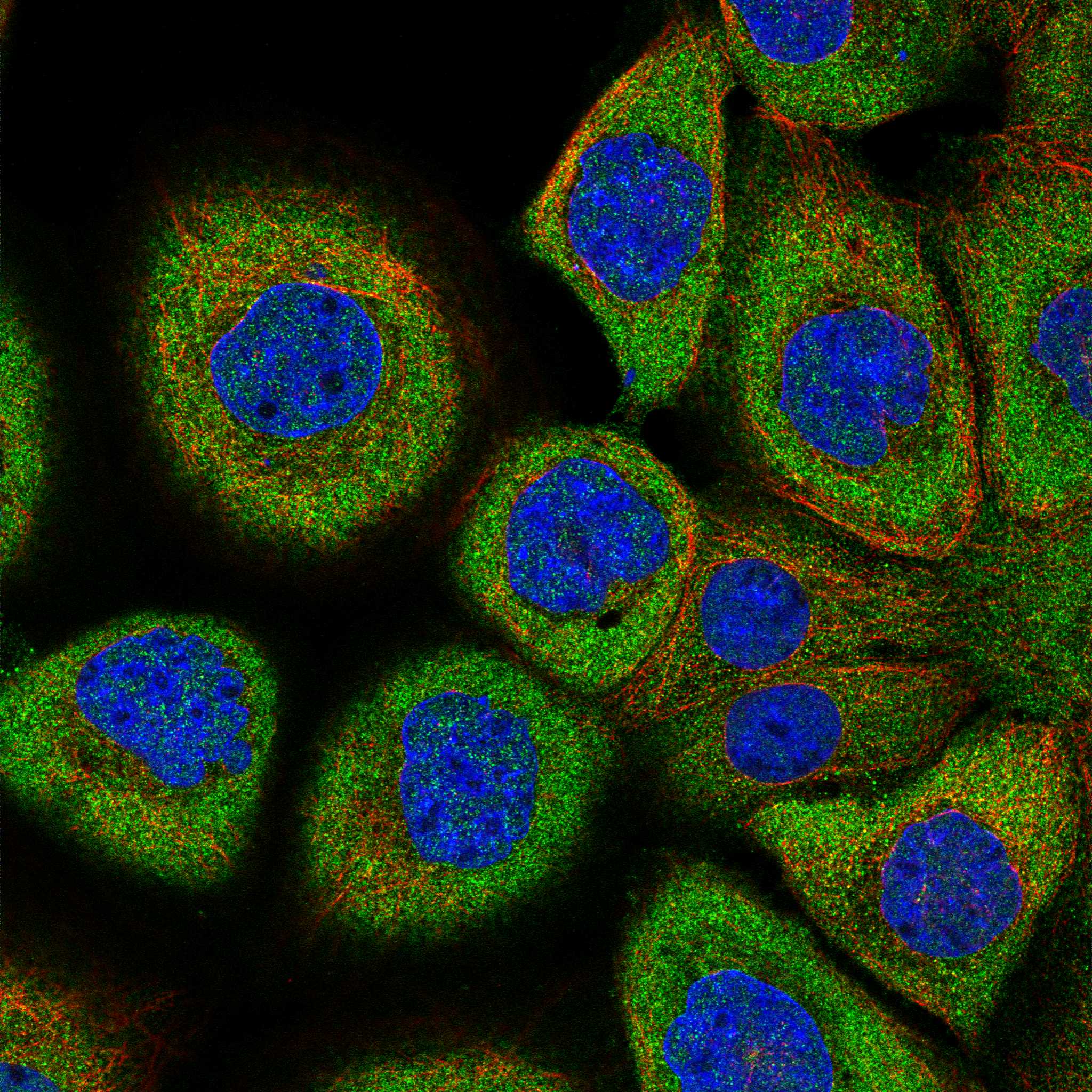 FCRLB fluorescence