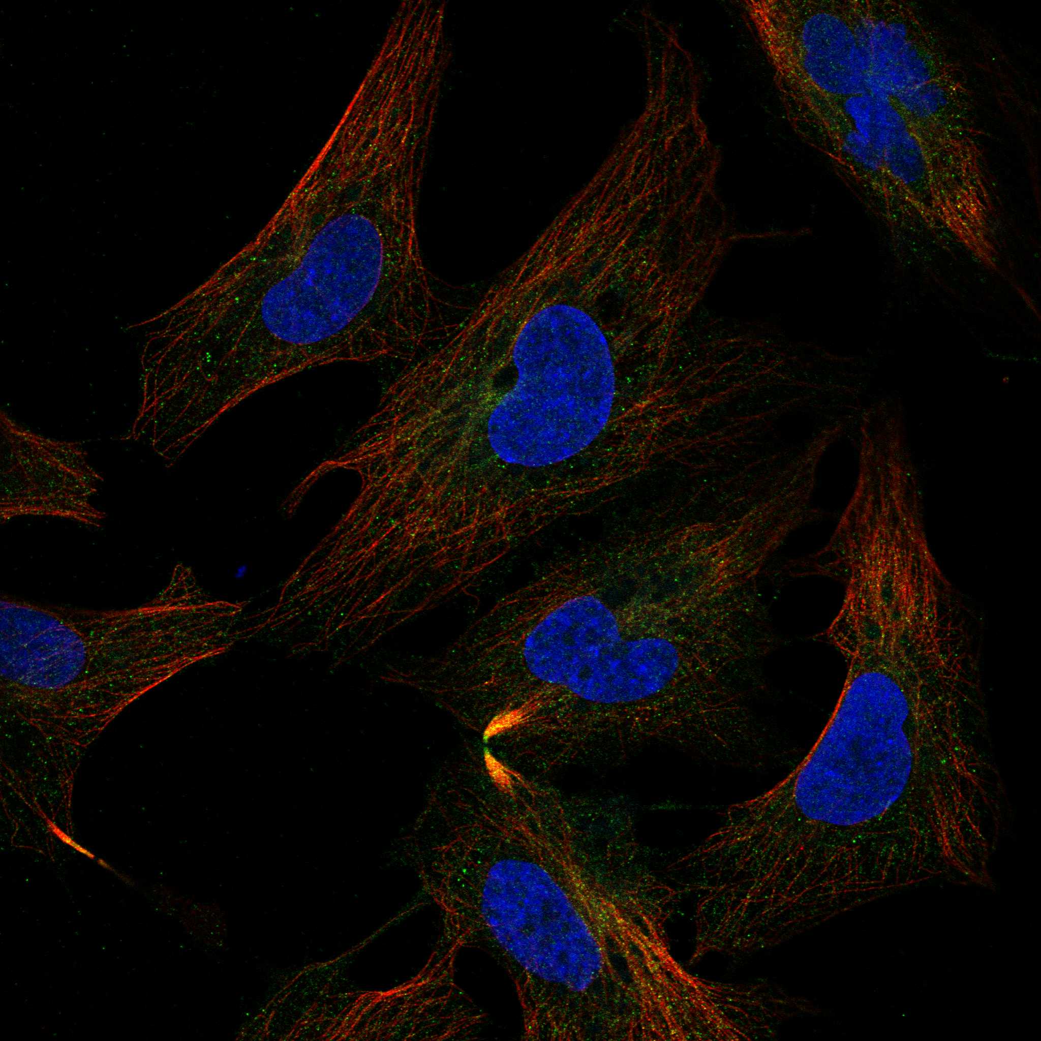 FGFR1 fluorescence
