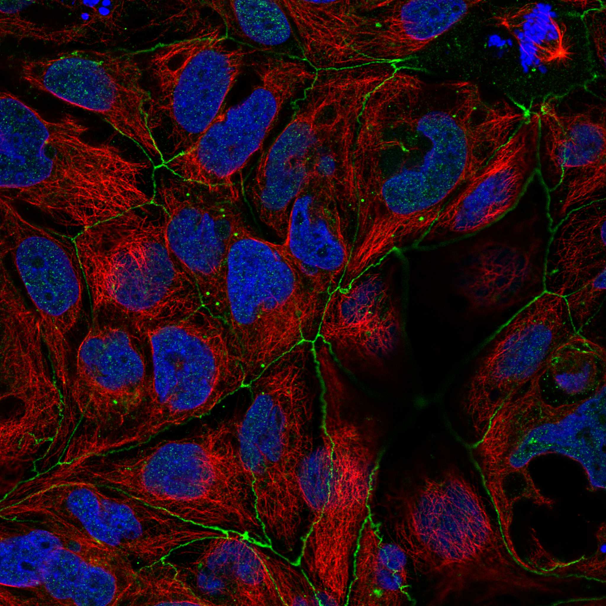 FGFR2 fluorescence
