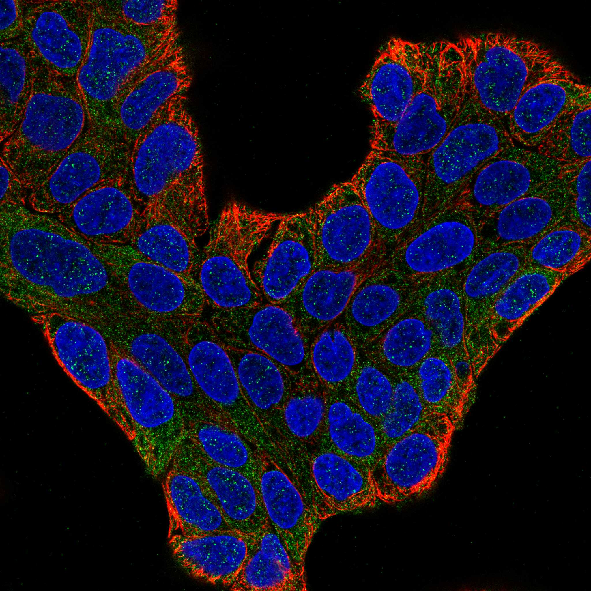 FGFR3 fluorescence